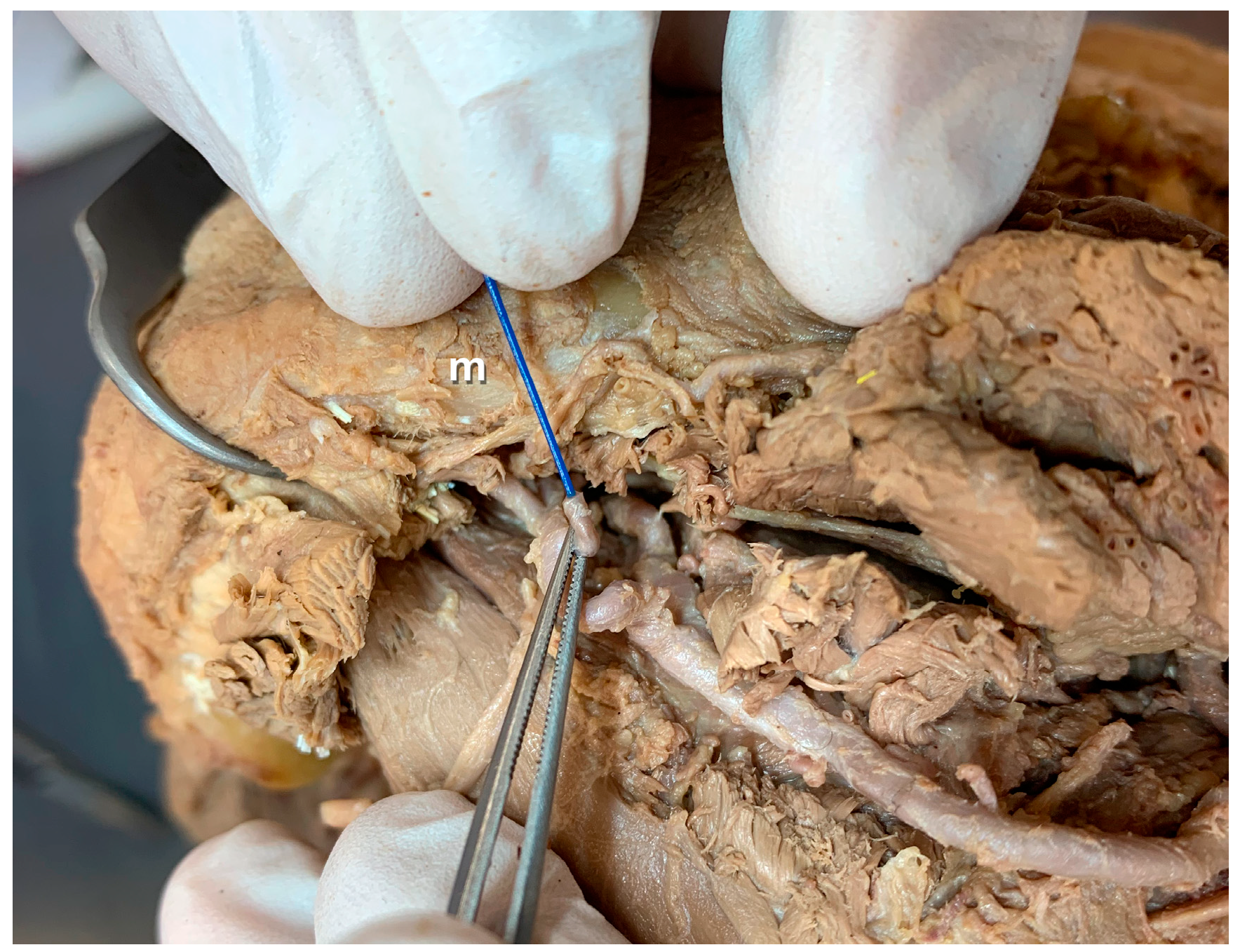 Preprints 110657 g001