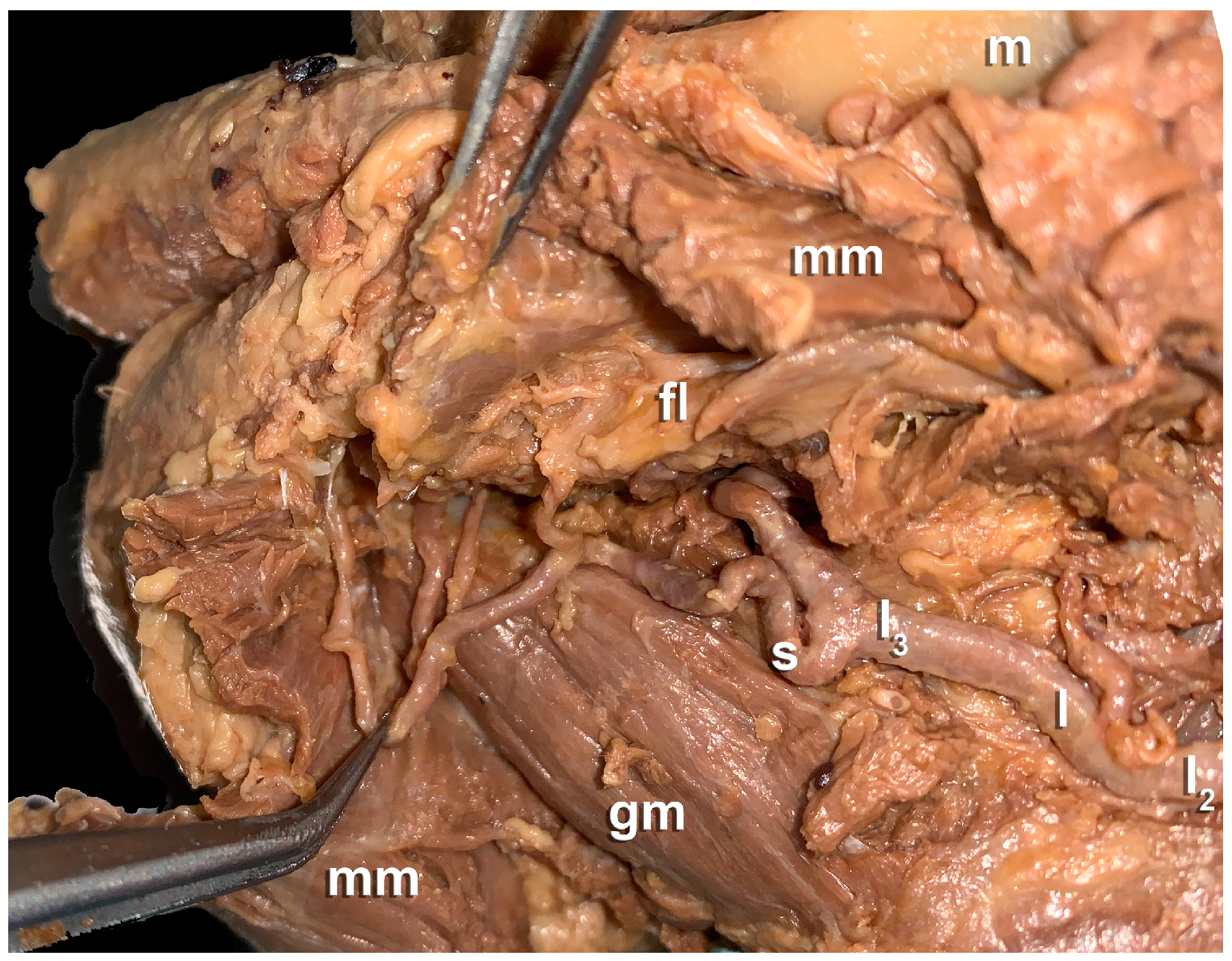 Preprints 110657 g002
