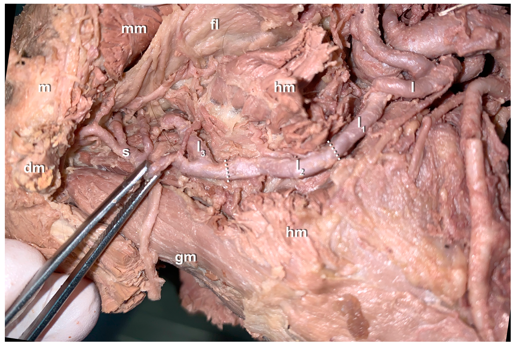 Preprints 110657 g003