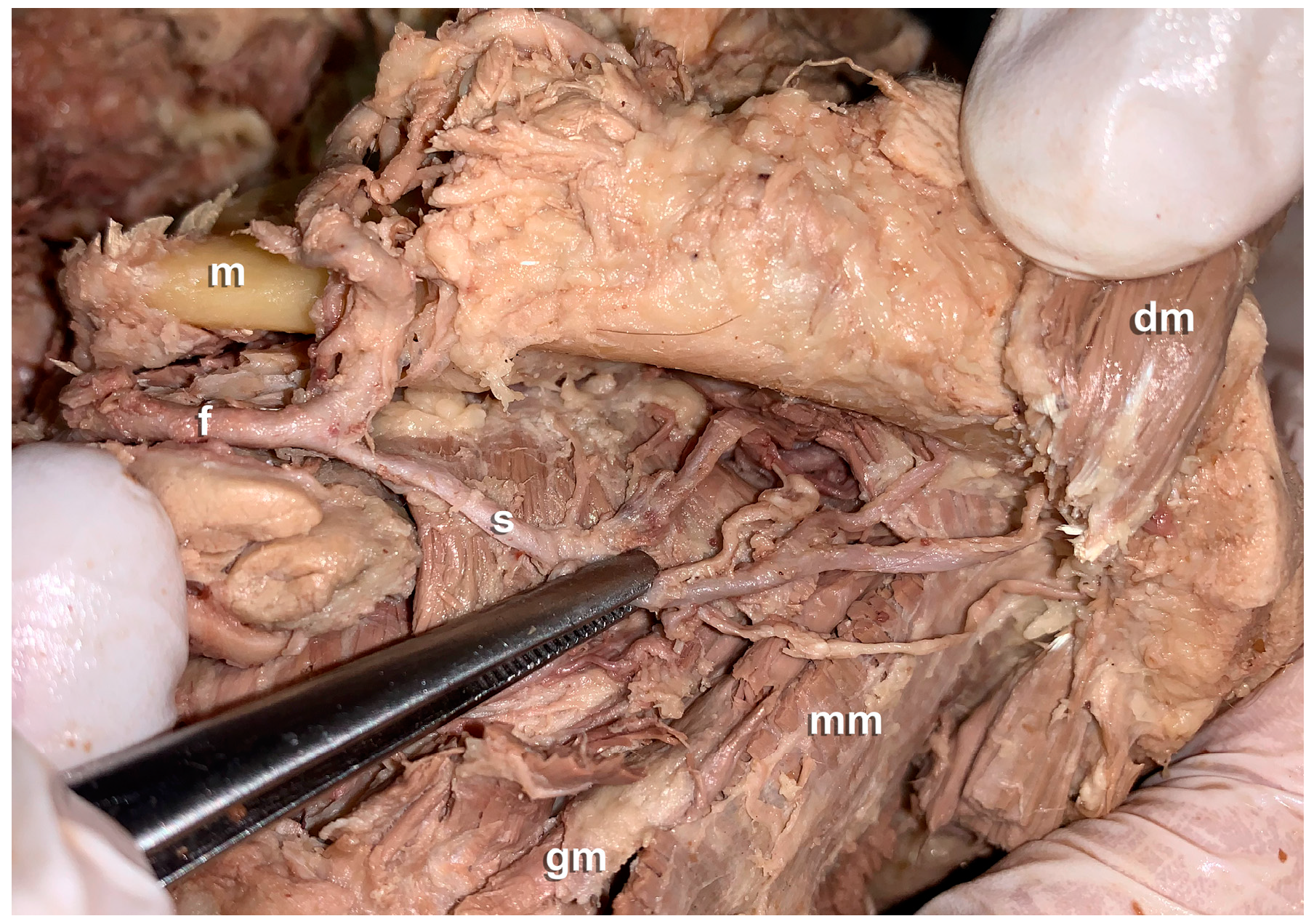 Preprints 110657 g004