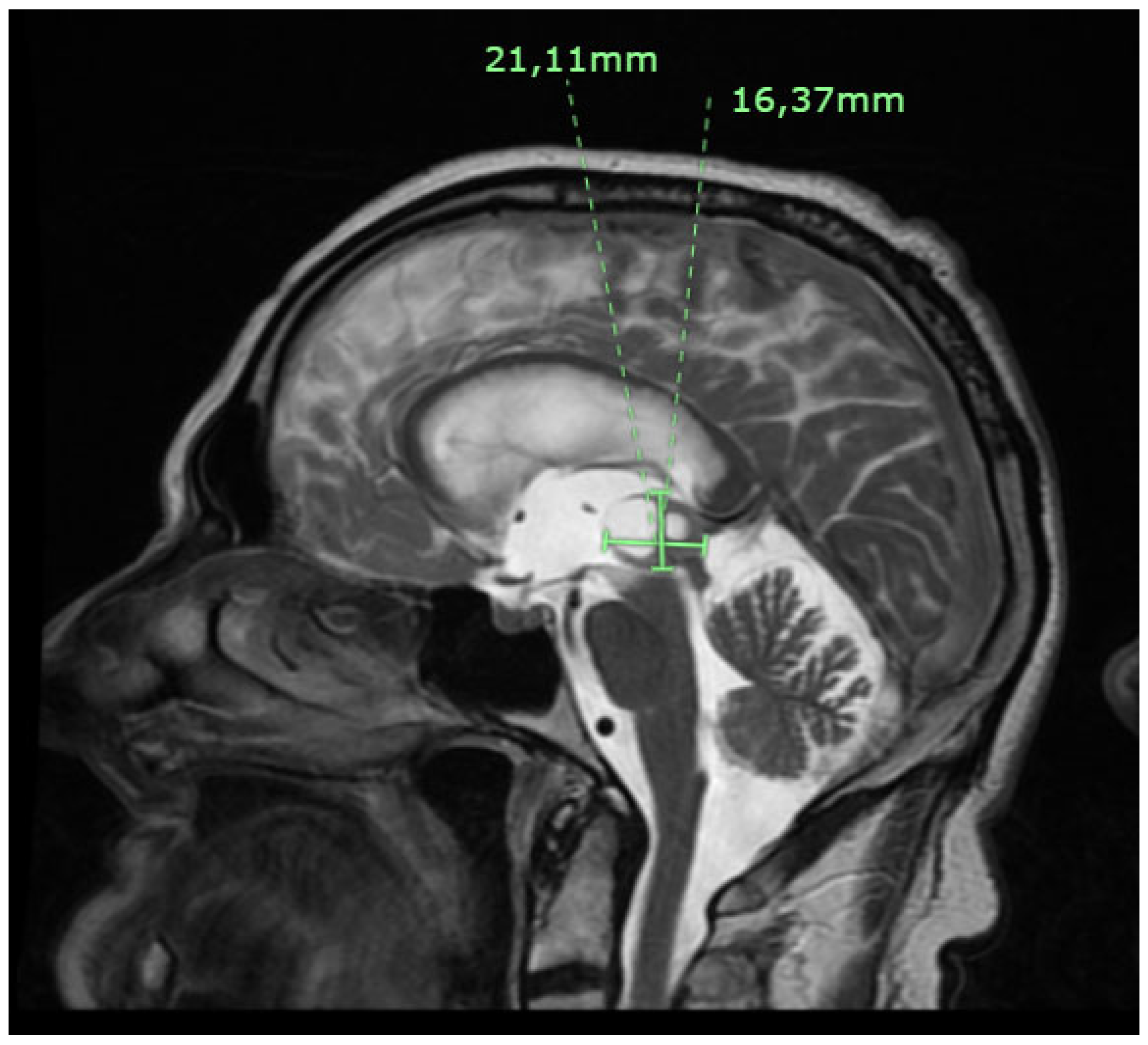 Preprints 120186 g001