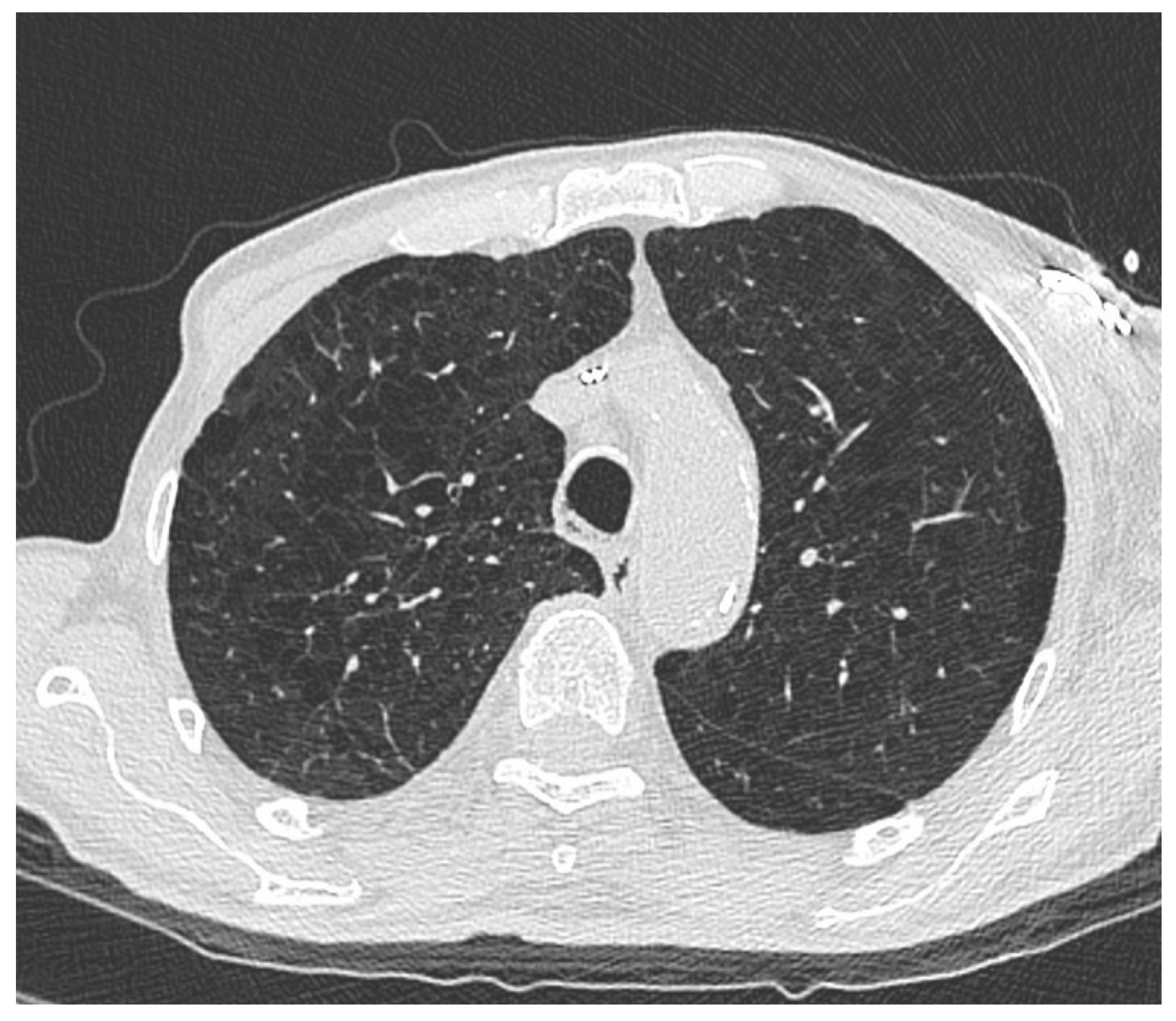 Preprints 178038 g002