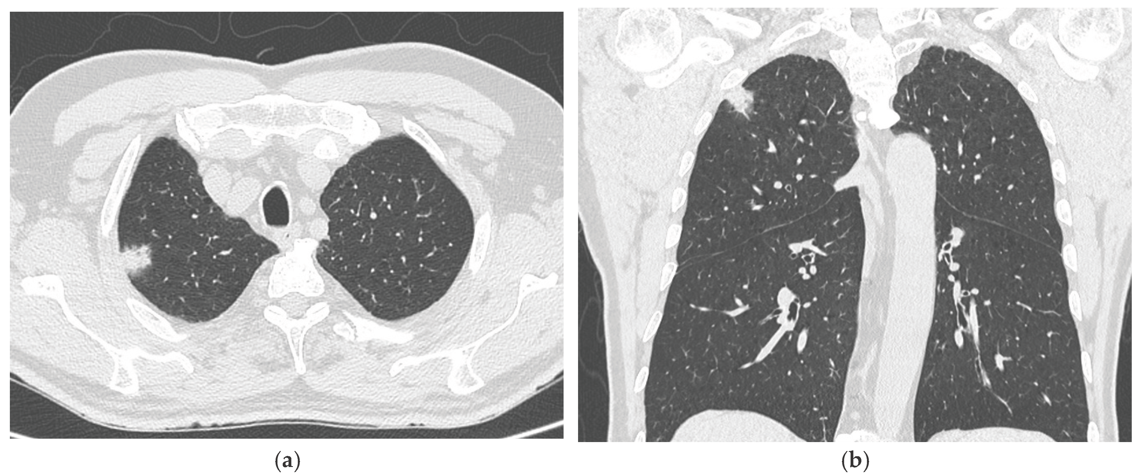 Preprints 178038 g003