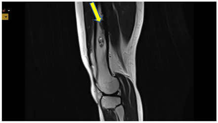 Preprints 164823 i003