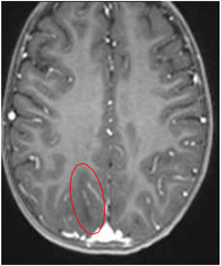 Preprints 196761 i005