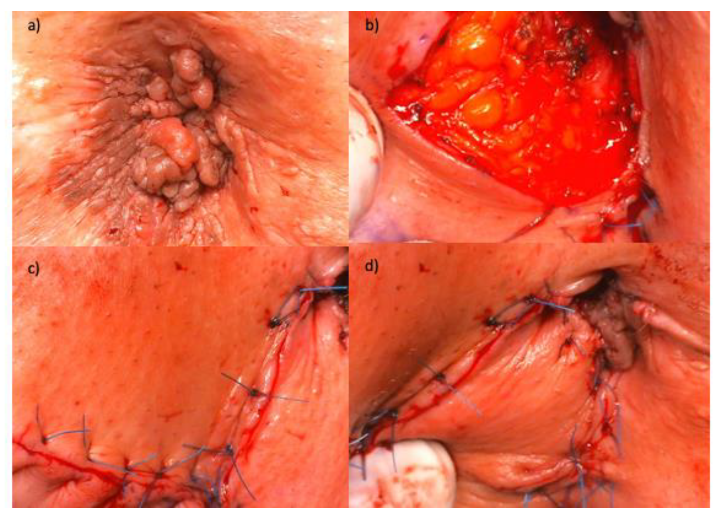 Preprints 73593 g003