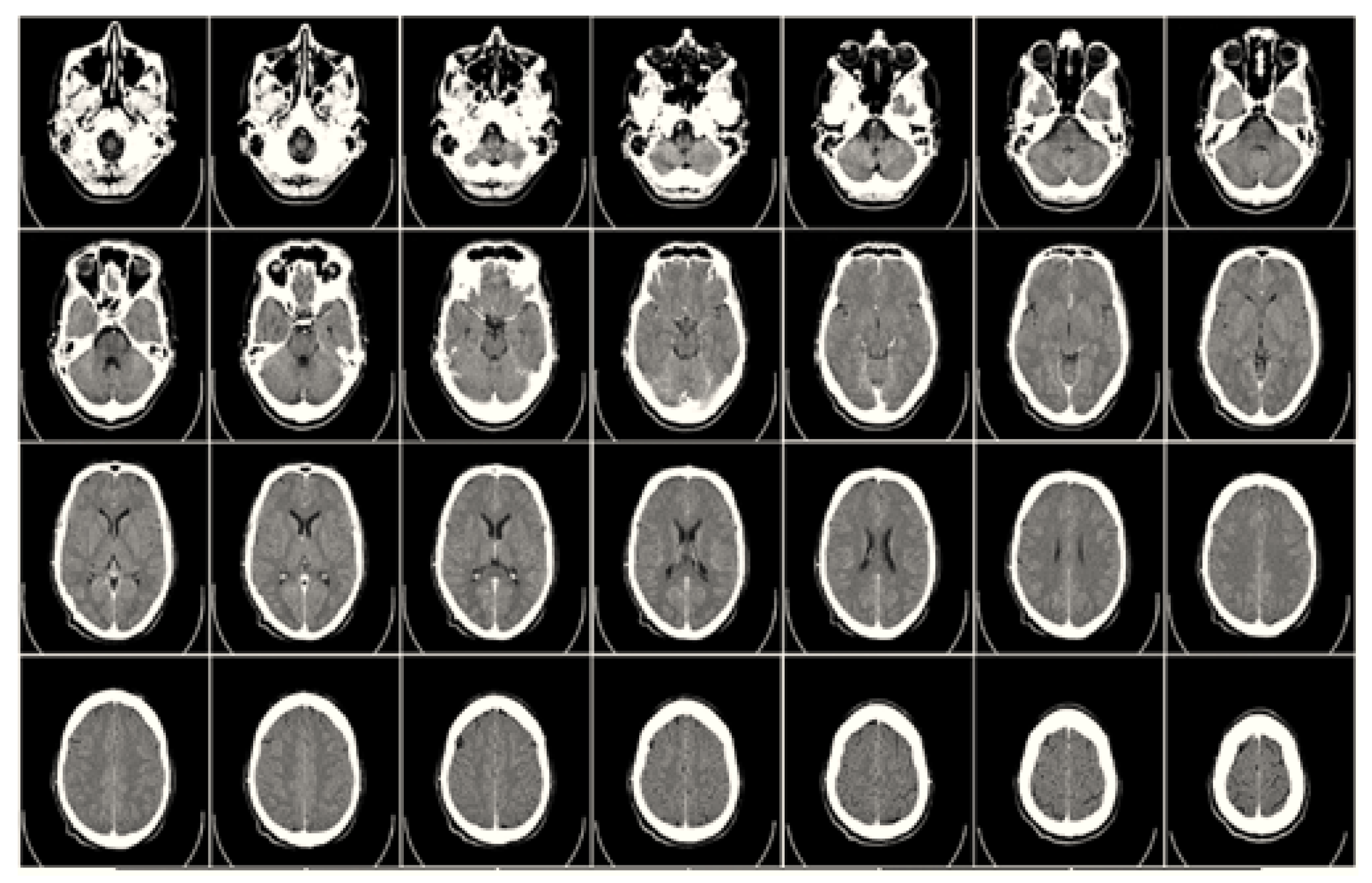 Preprints 144171 g001