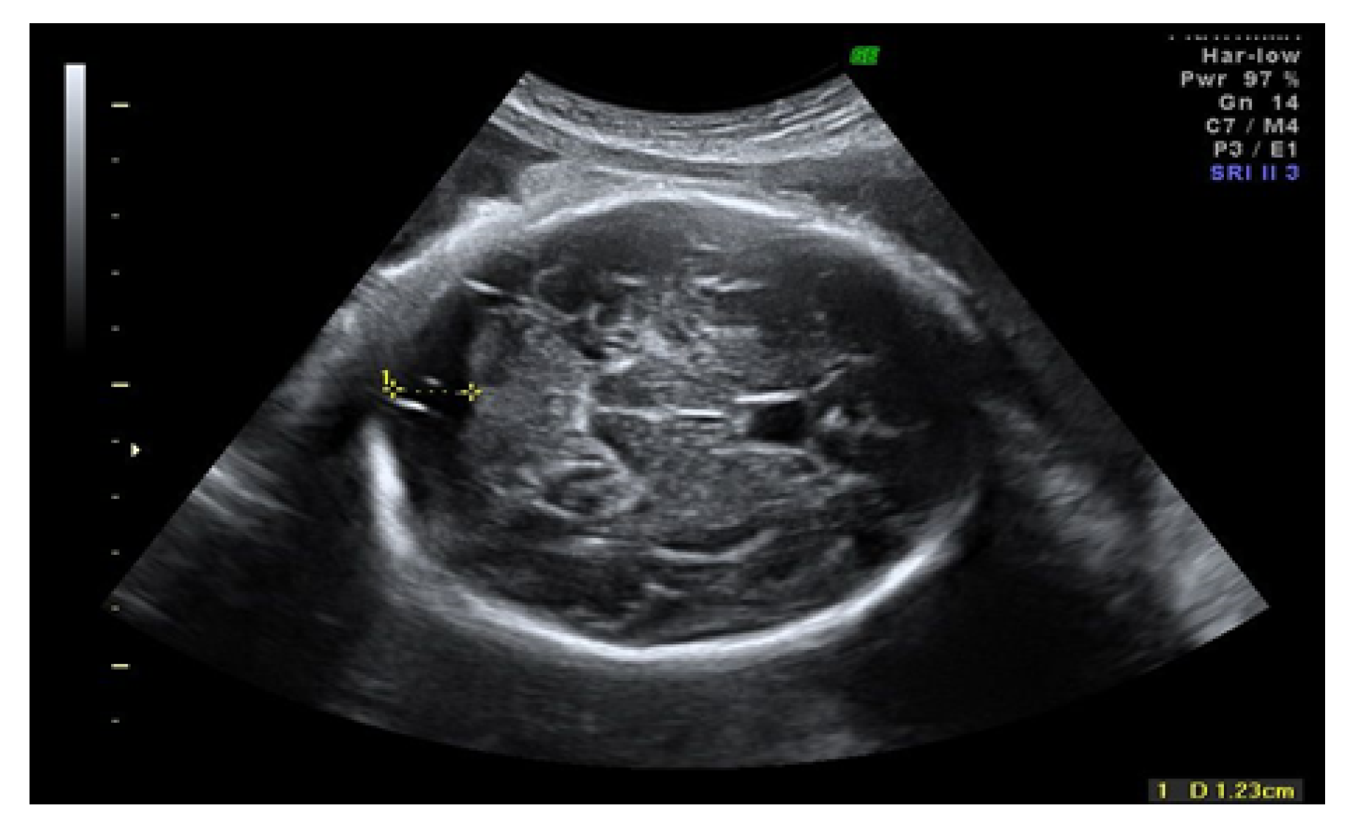 Preprints 144171 g002