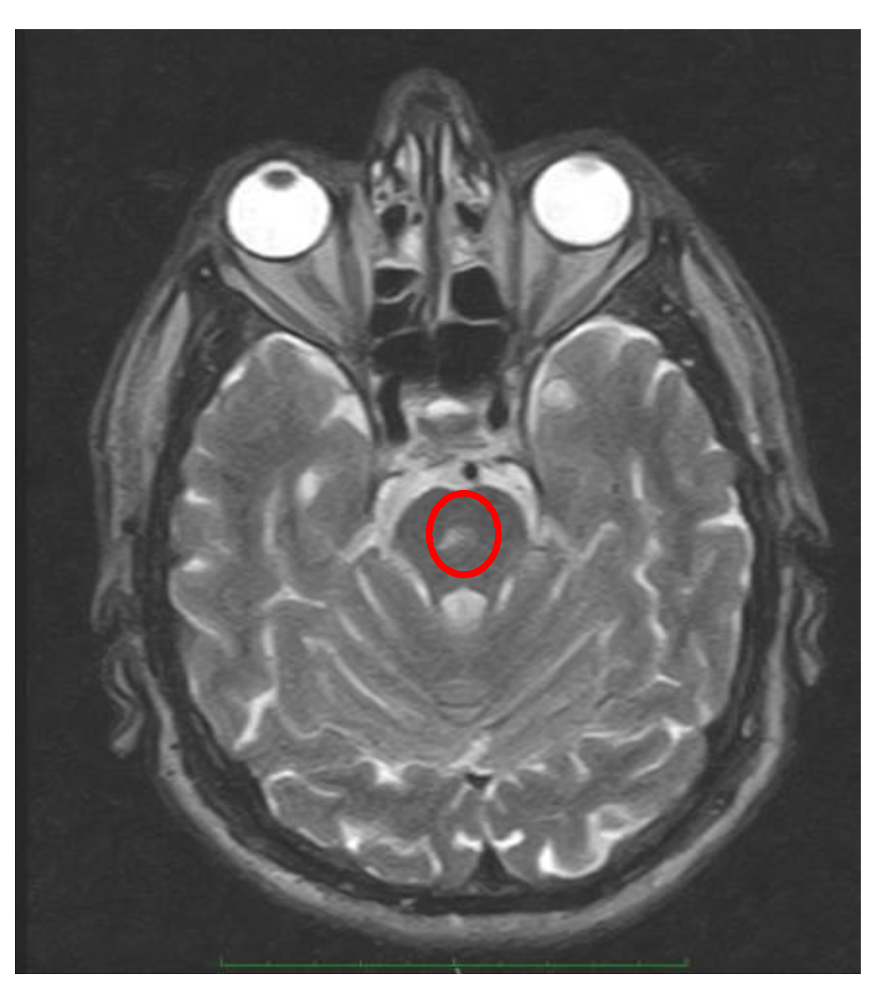 Preprints 173760 g004