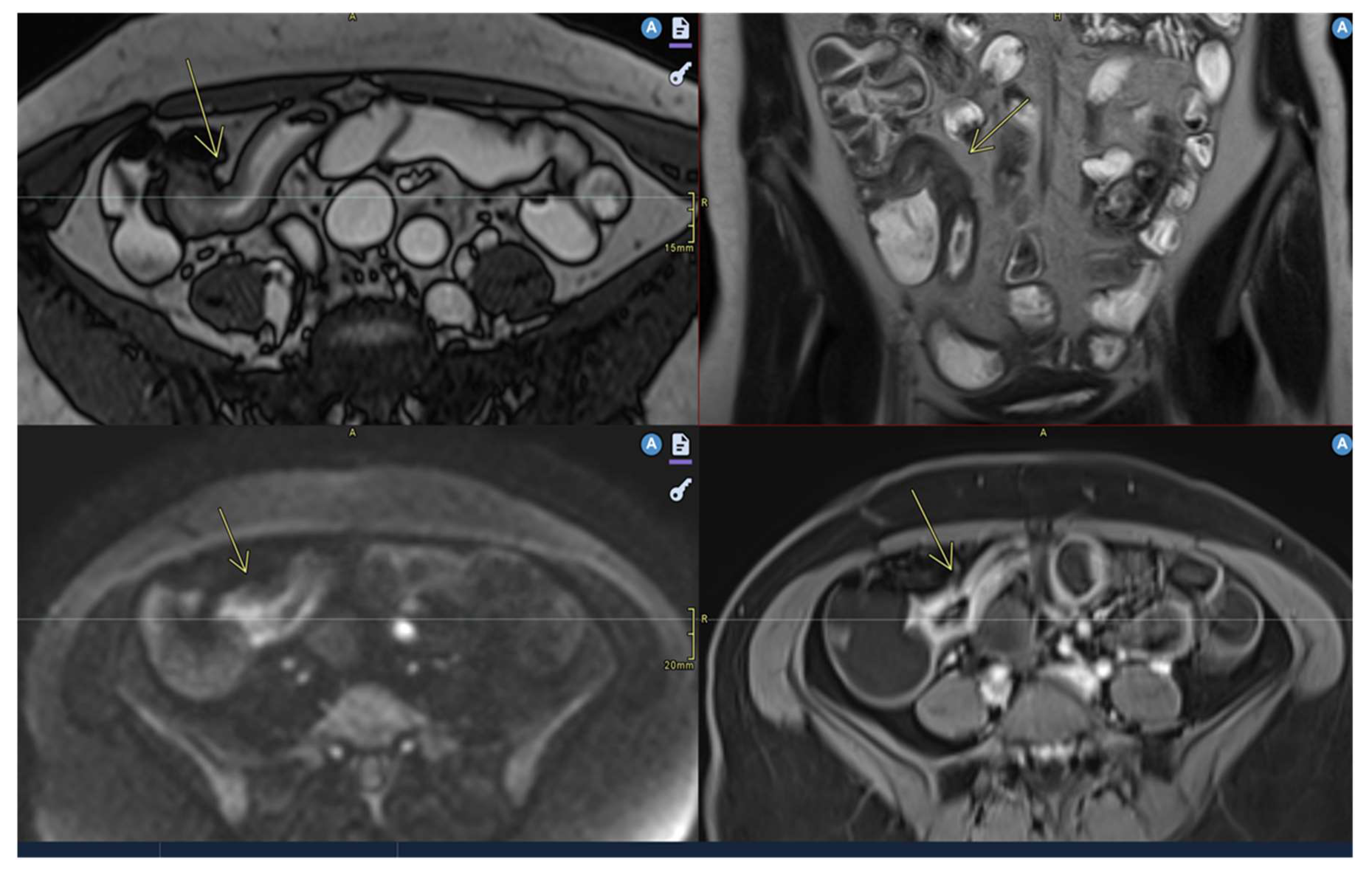 Preprints 157580 g001