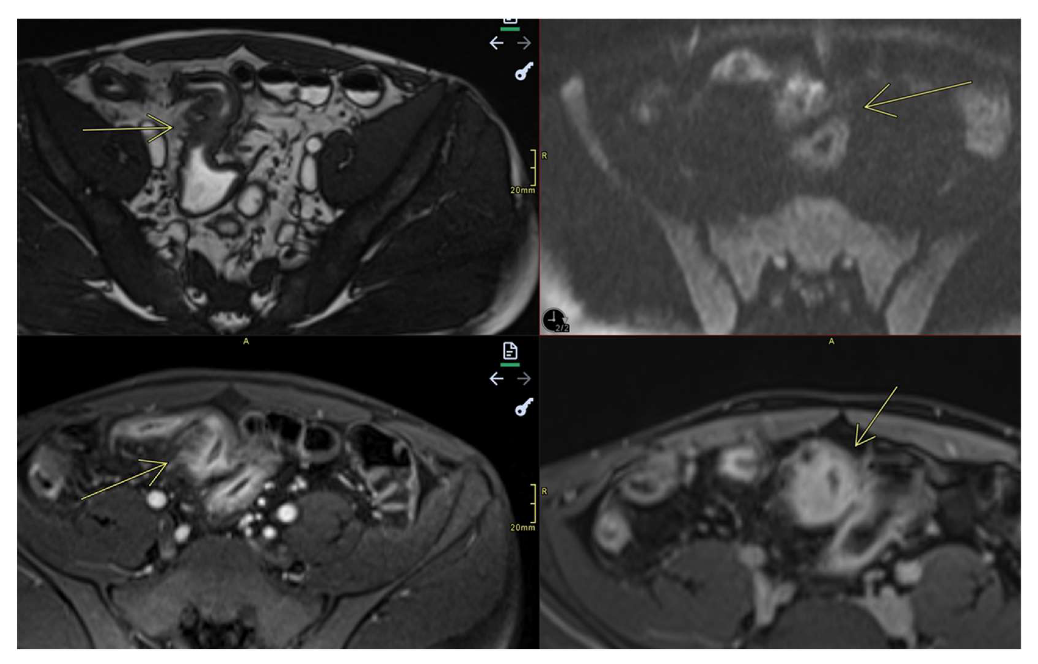 Preprints 157580 g004