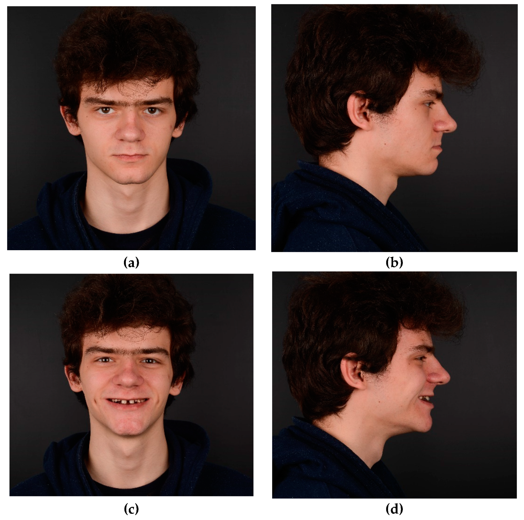 Preprints 100616 g001