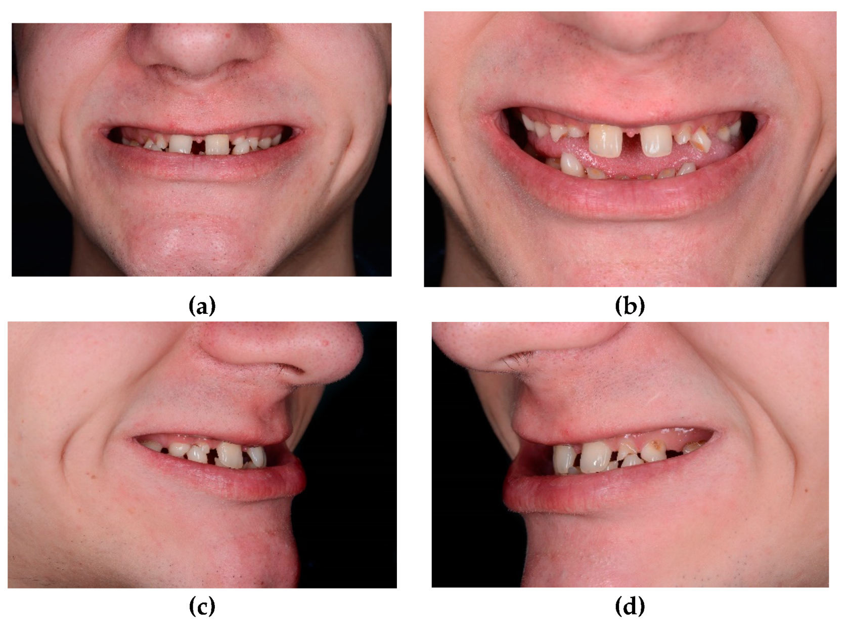 Preprints 100616 g002