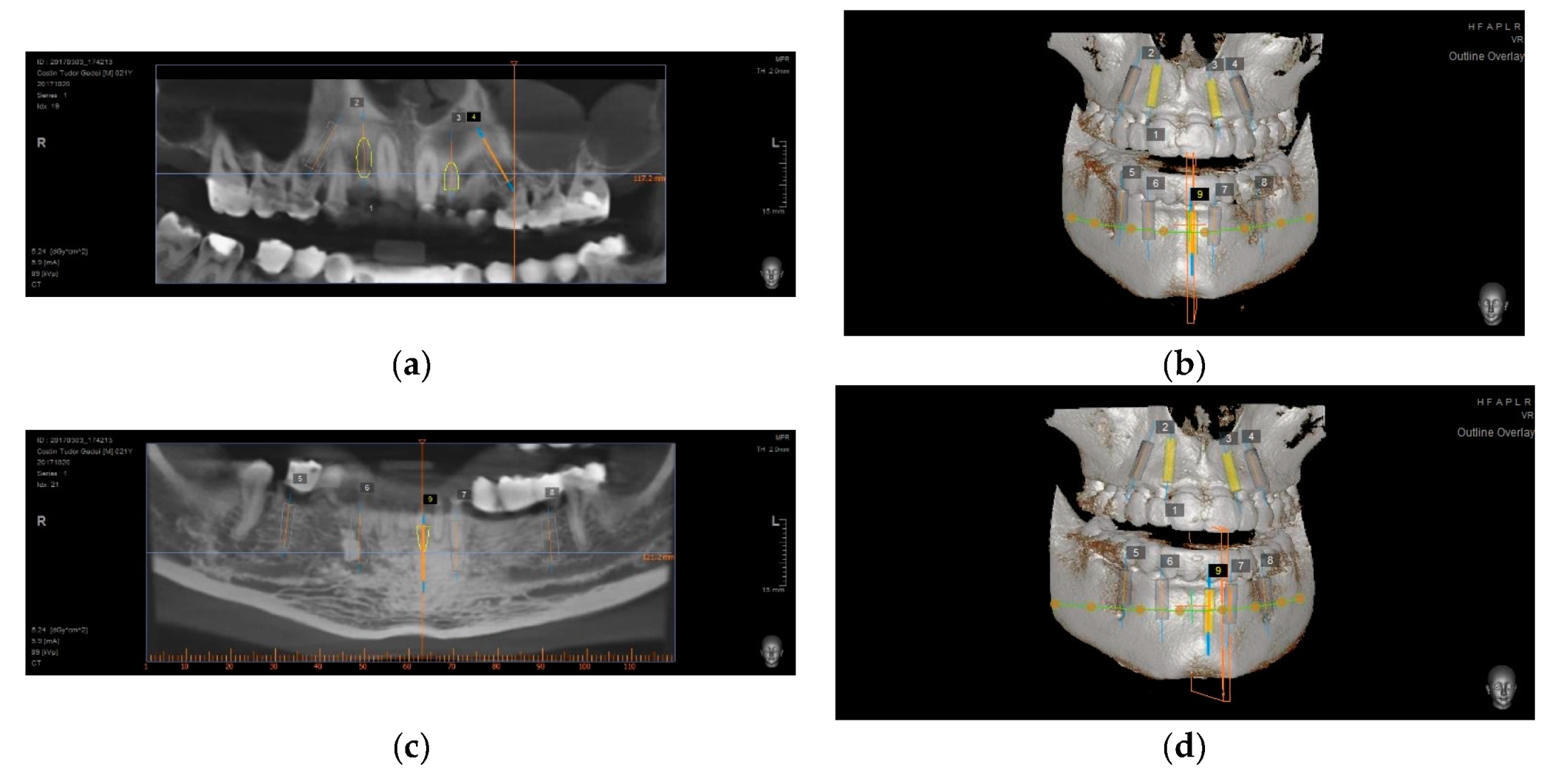 Preprints 100616 g008