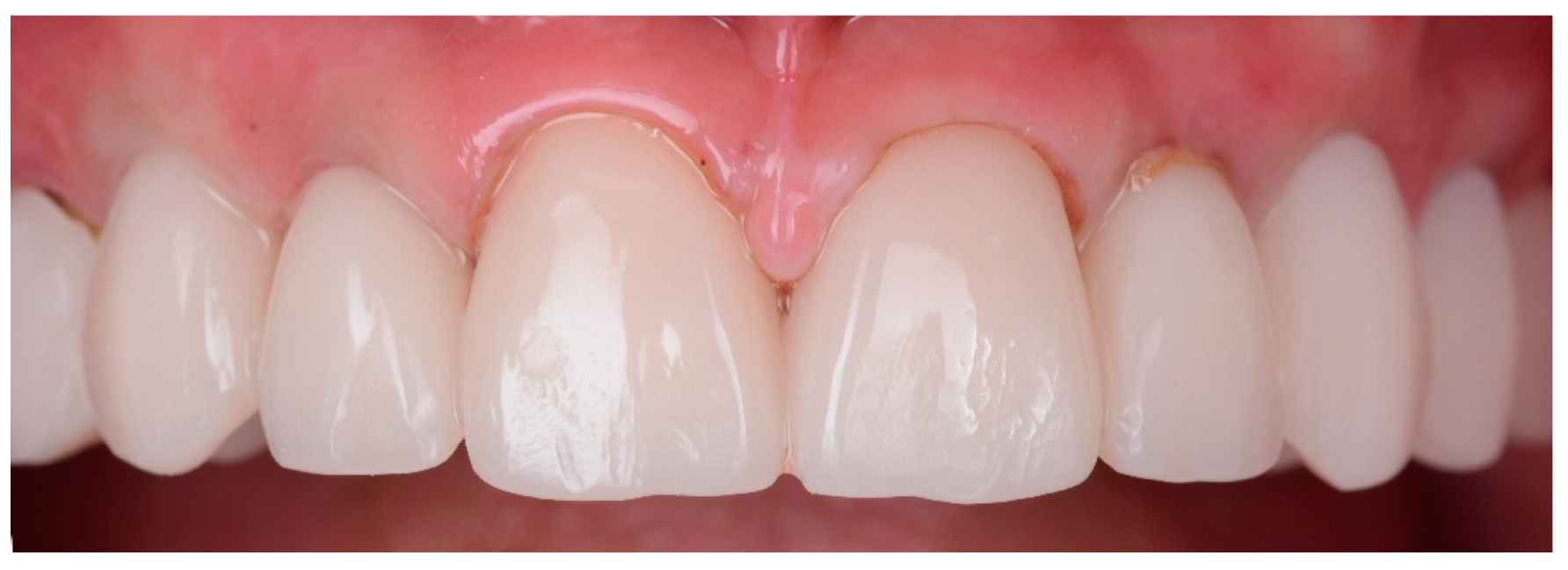 Preprints 100616 g011