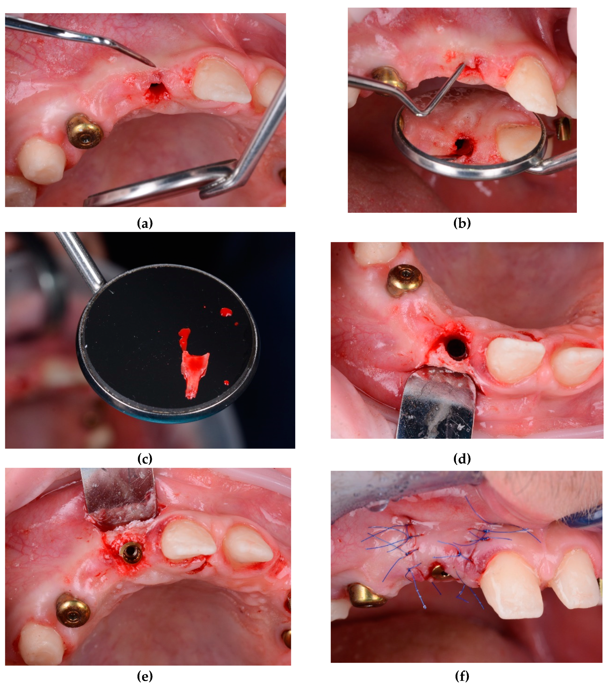 Preprints 100616 g014