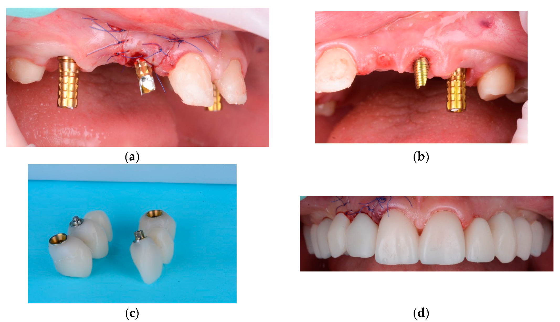 Preprints 100616 g015