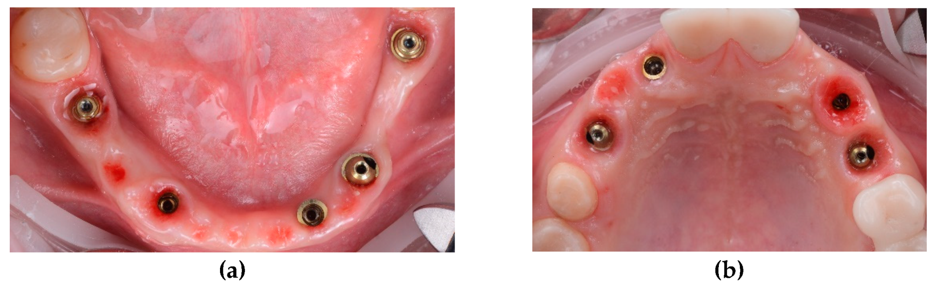 Preprints 100616 g016