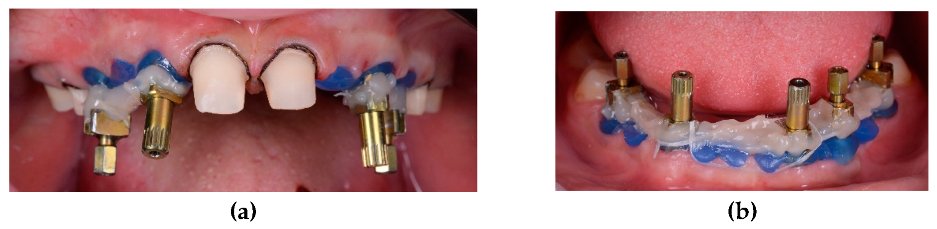 Preprints 100616 g017