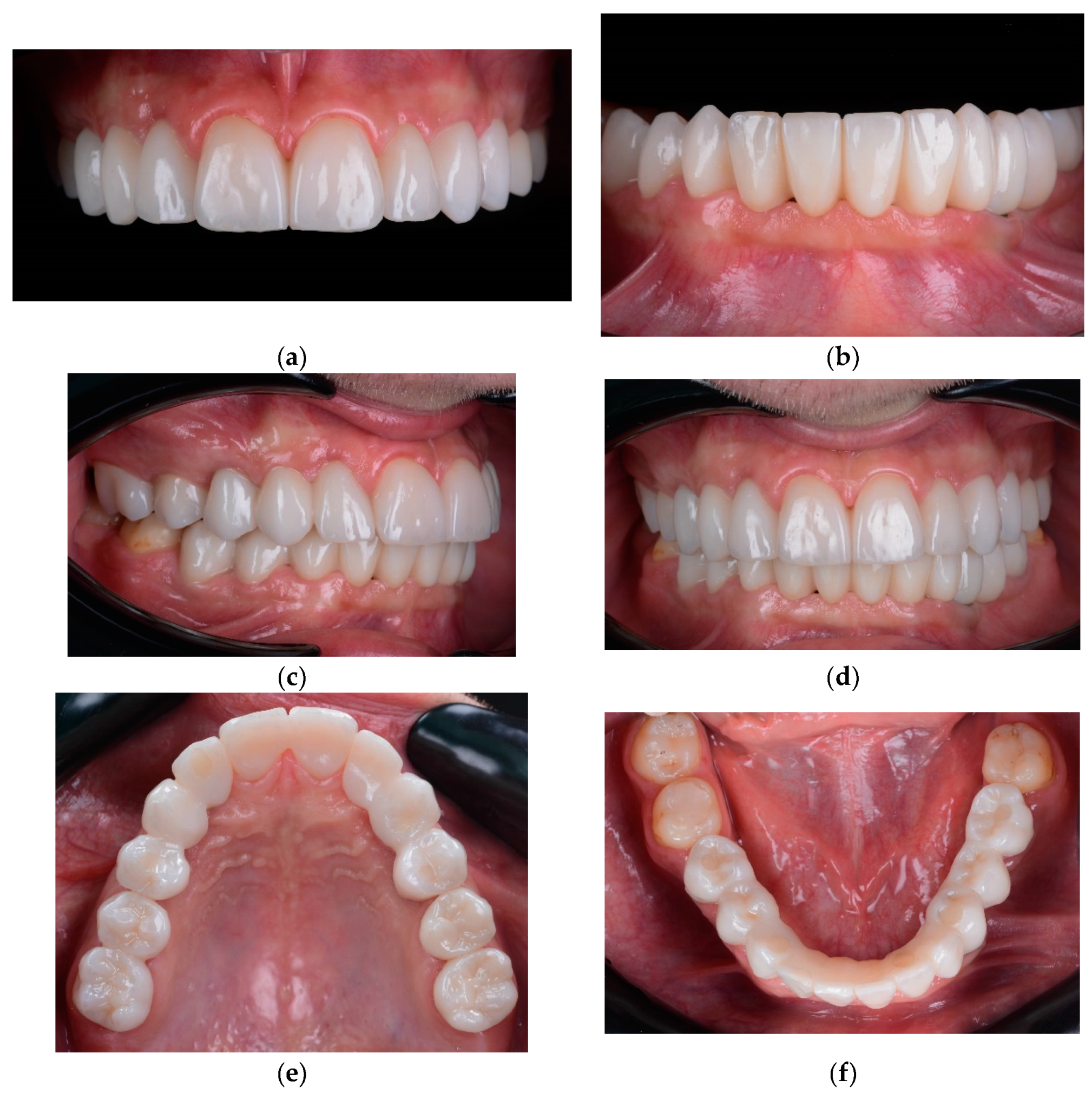 Preprints 100616 g018