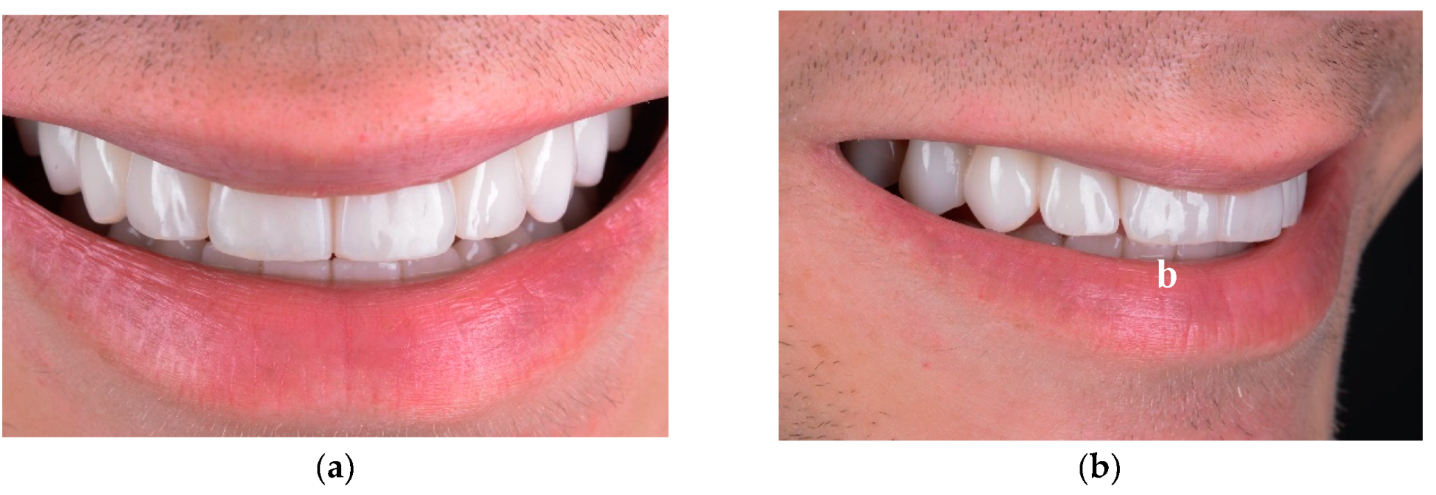 Preprints 100616 g019