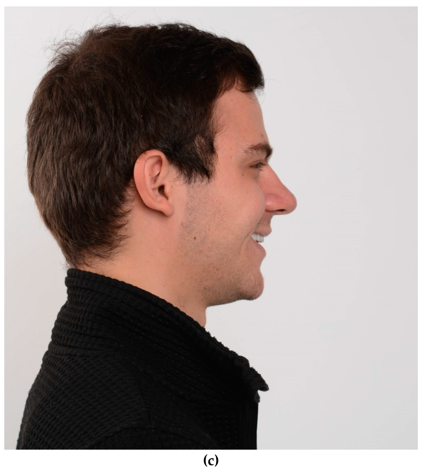 Preprints 100616 g020b