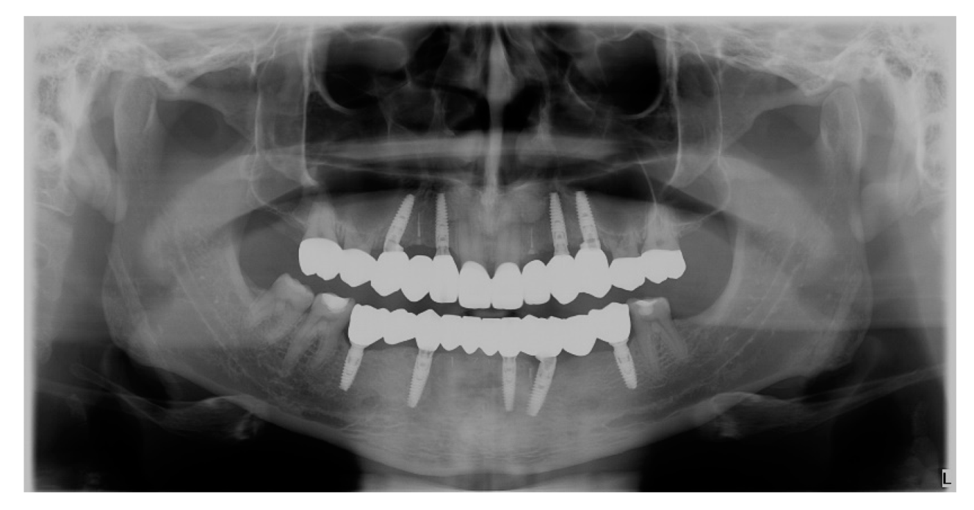 Preprints 100616 g021