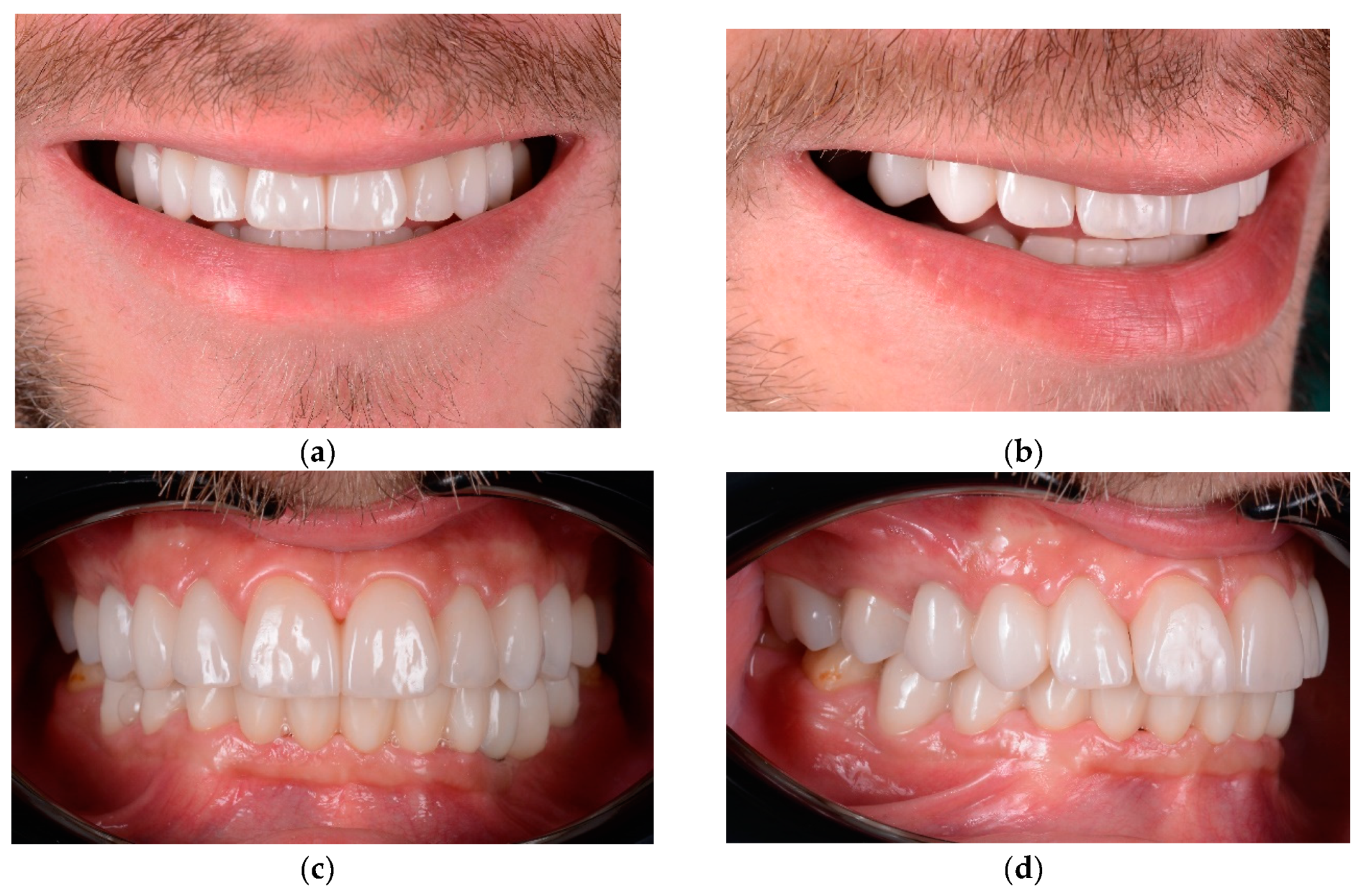 Preprints 100616 g022