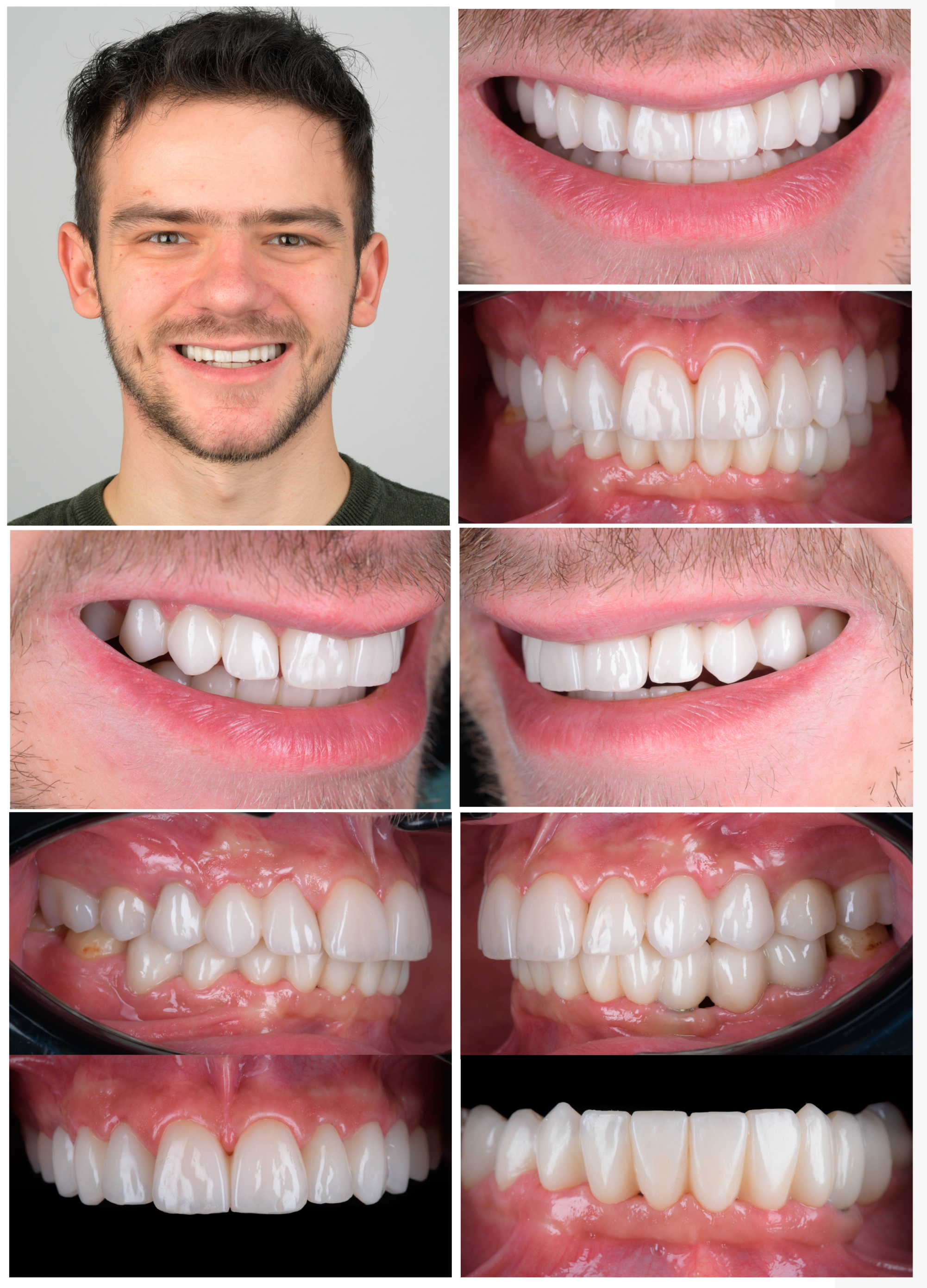 Preprints 100616 g024