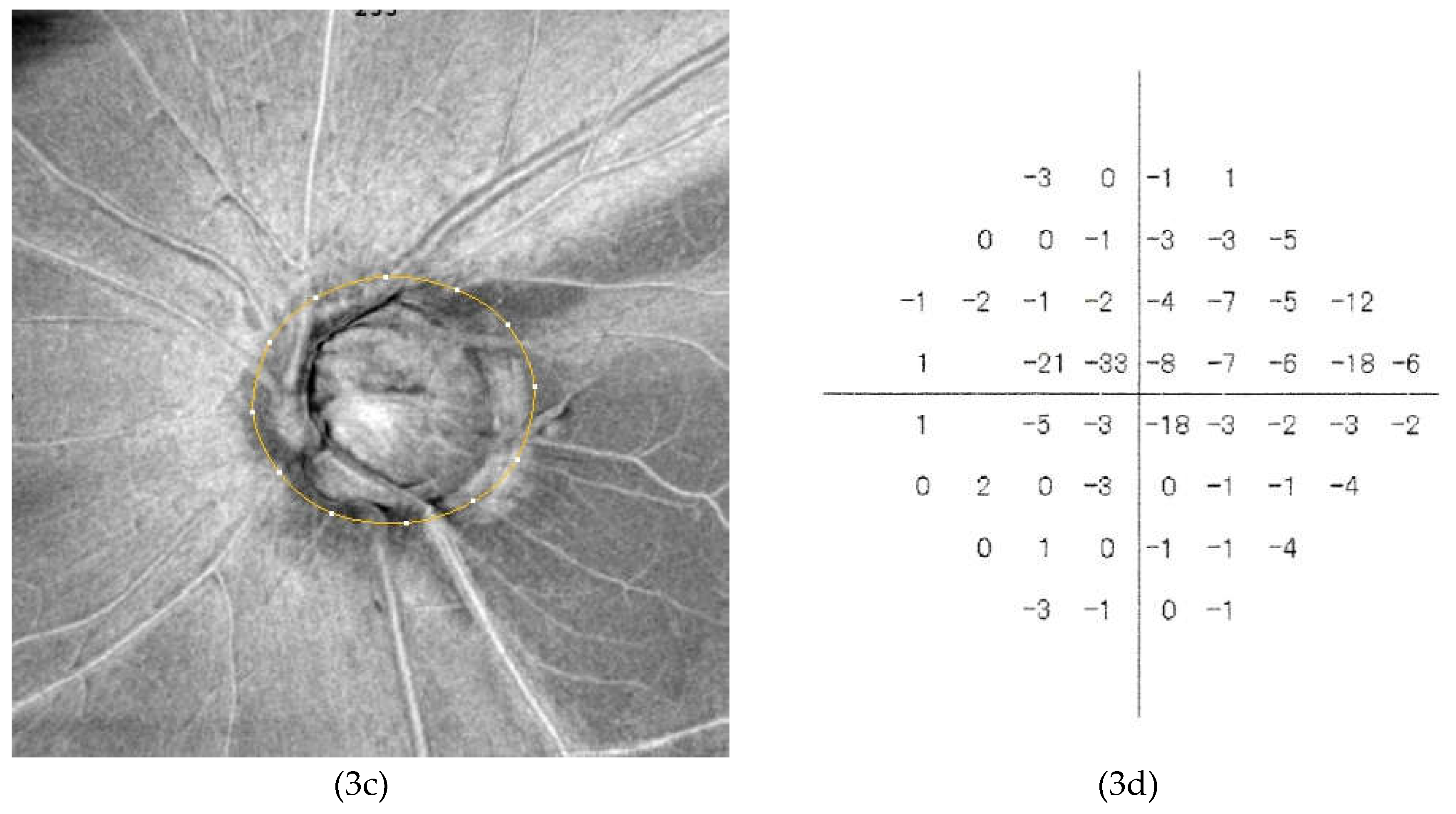Preprints 194120 g003b