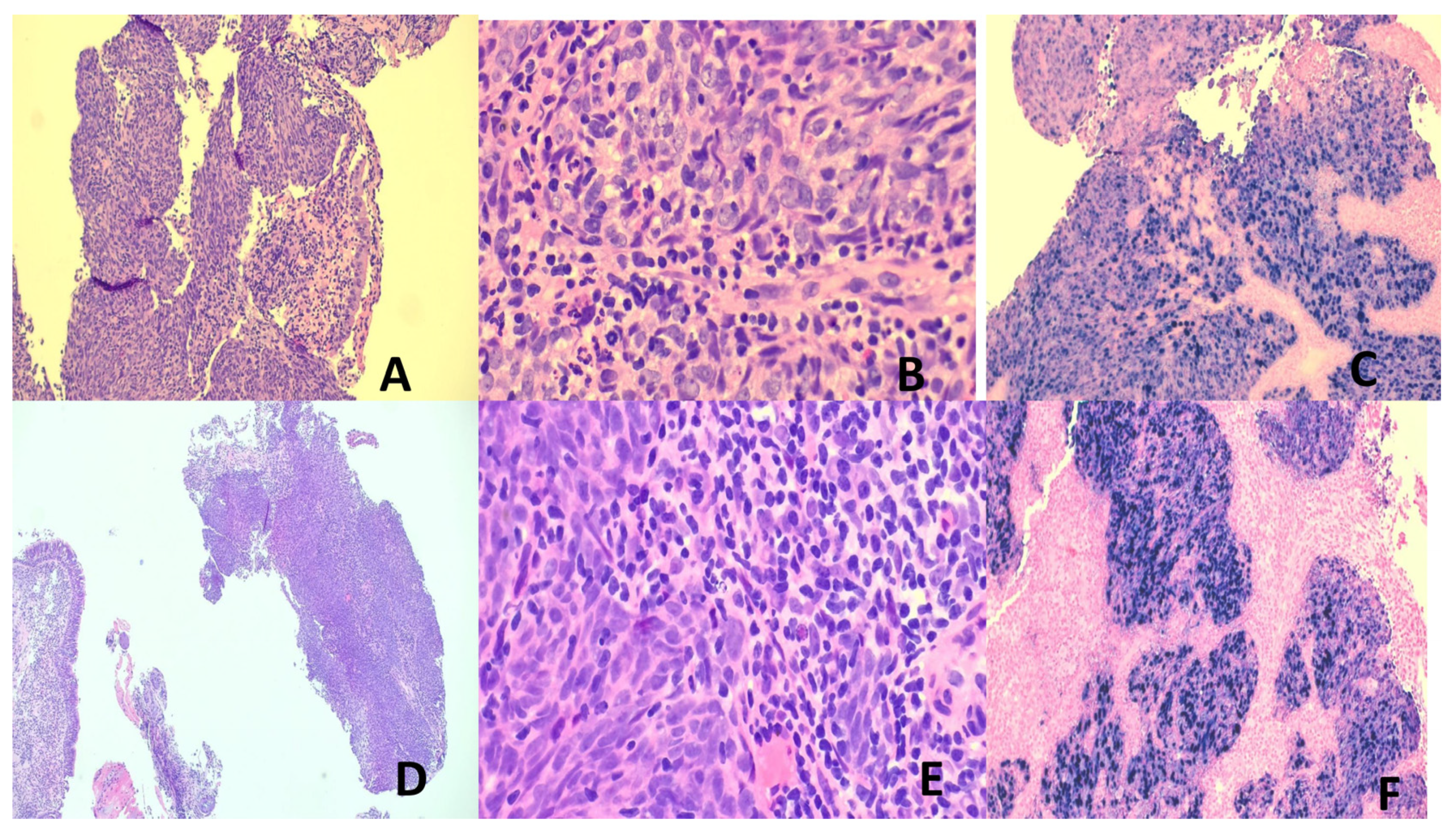 Preprints 170245 g002