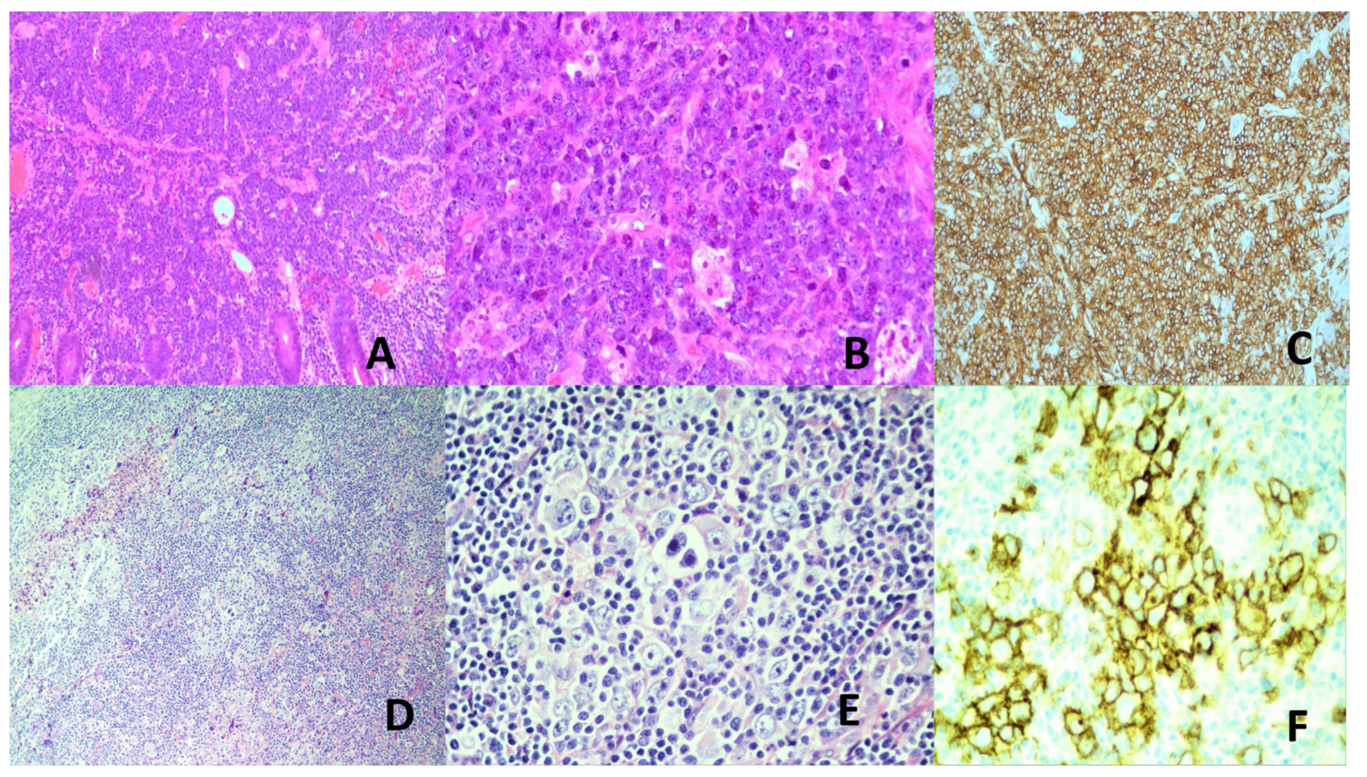 Preprints 170245 g003