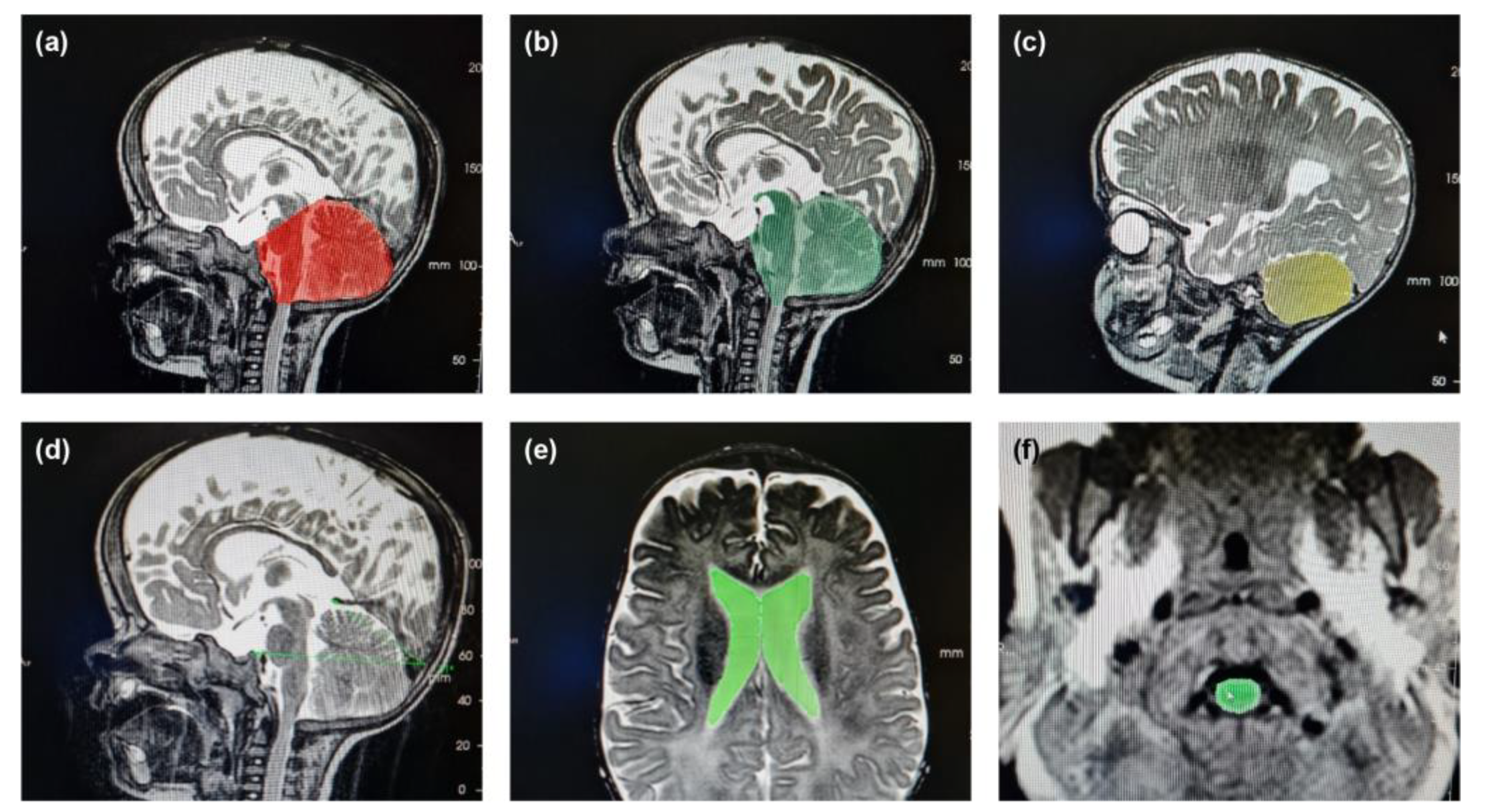 Preprints 120330 g001