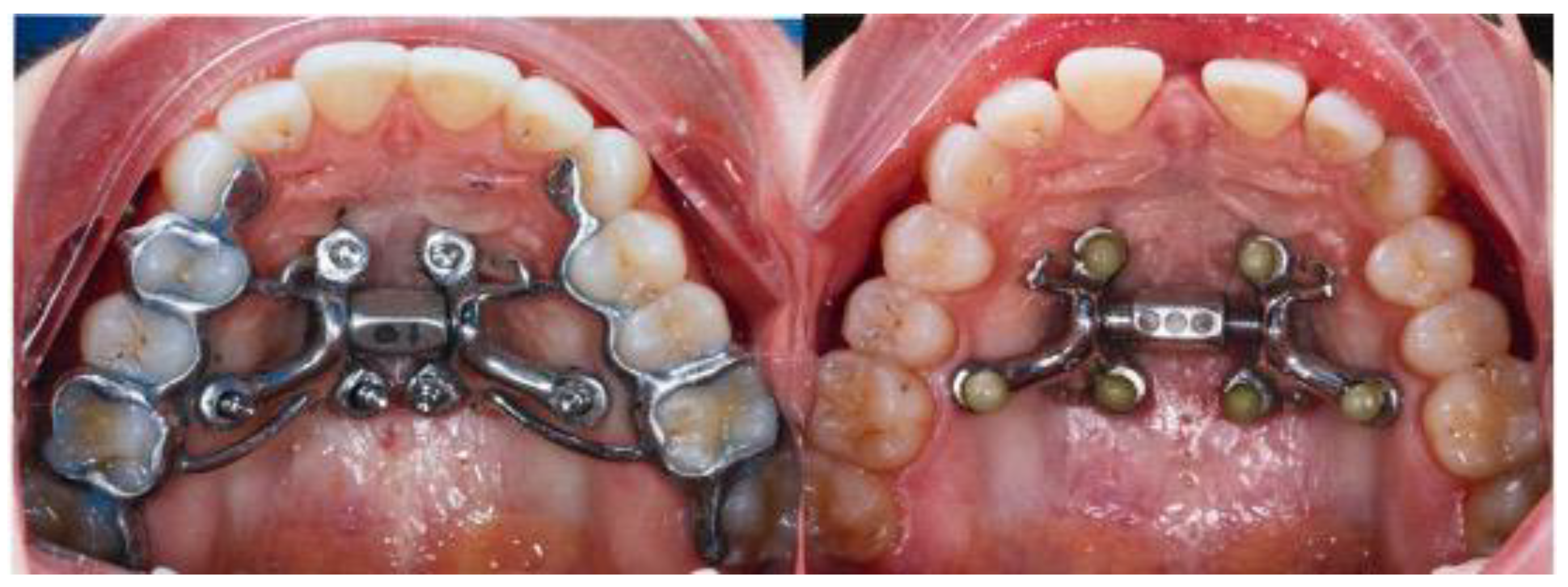 Preprints 163880 g001