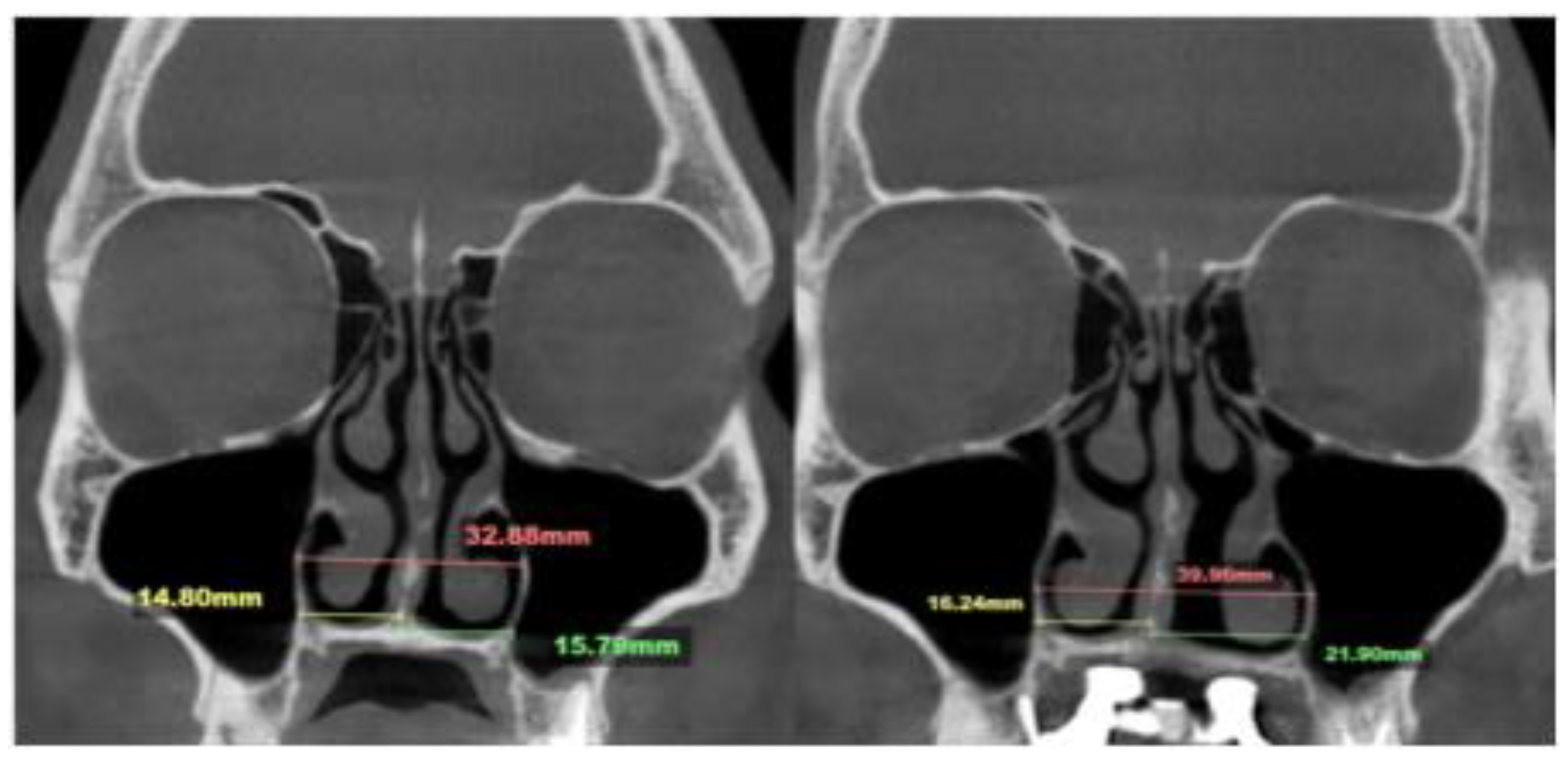 Preprints 163880 g006