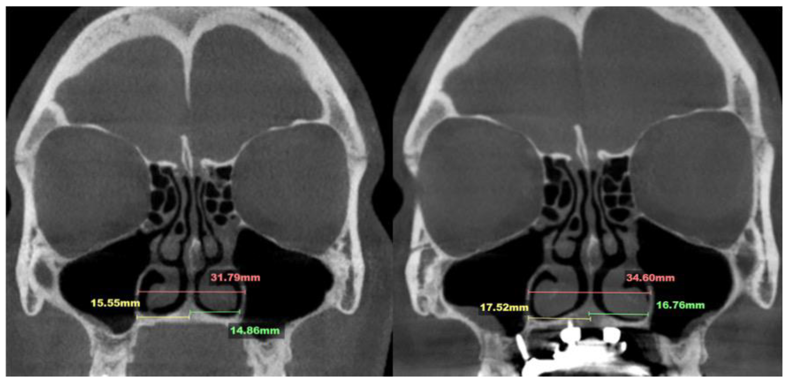 Preprints 163880 g008