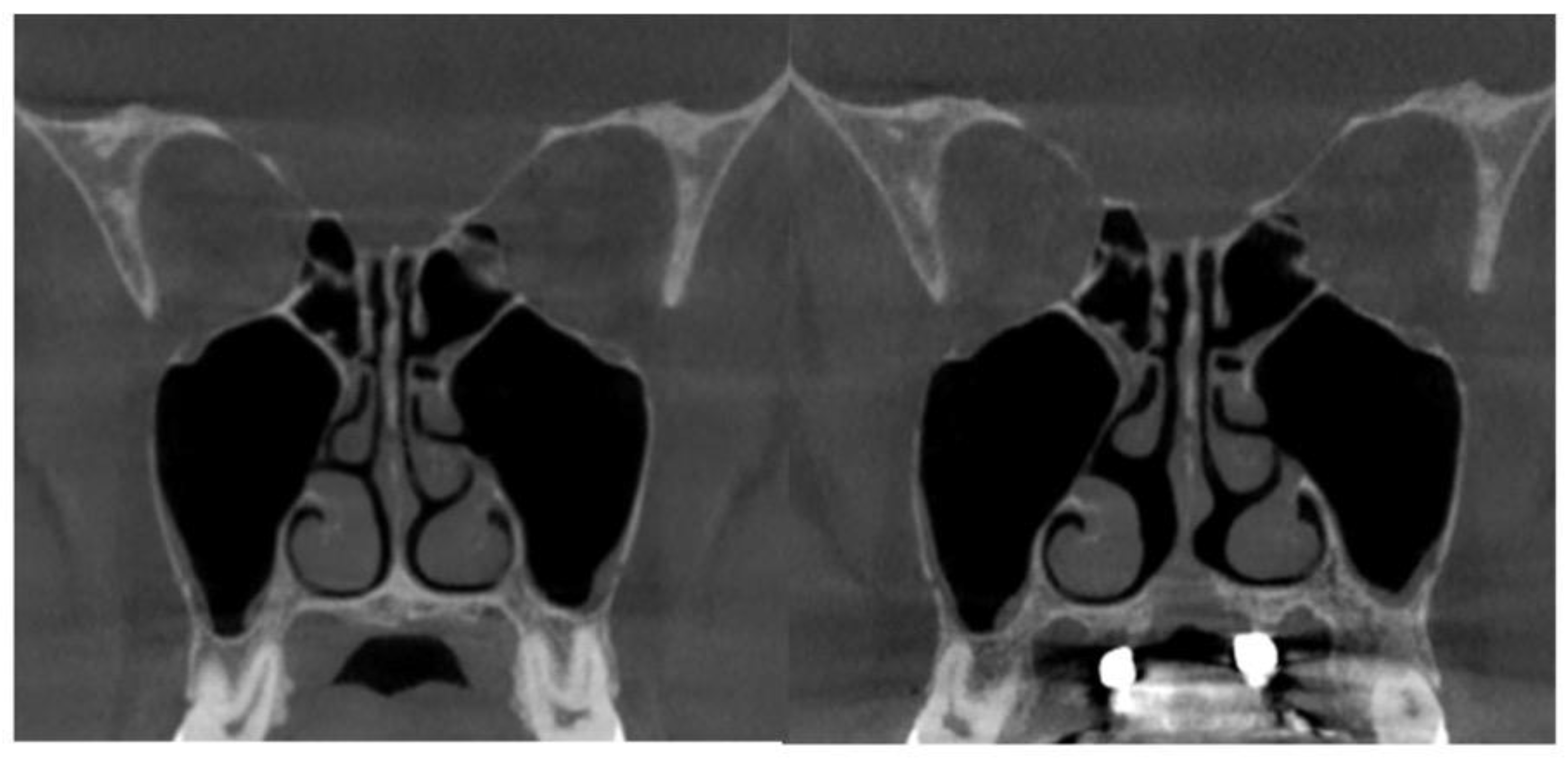 Preprints 163880 g009