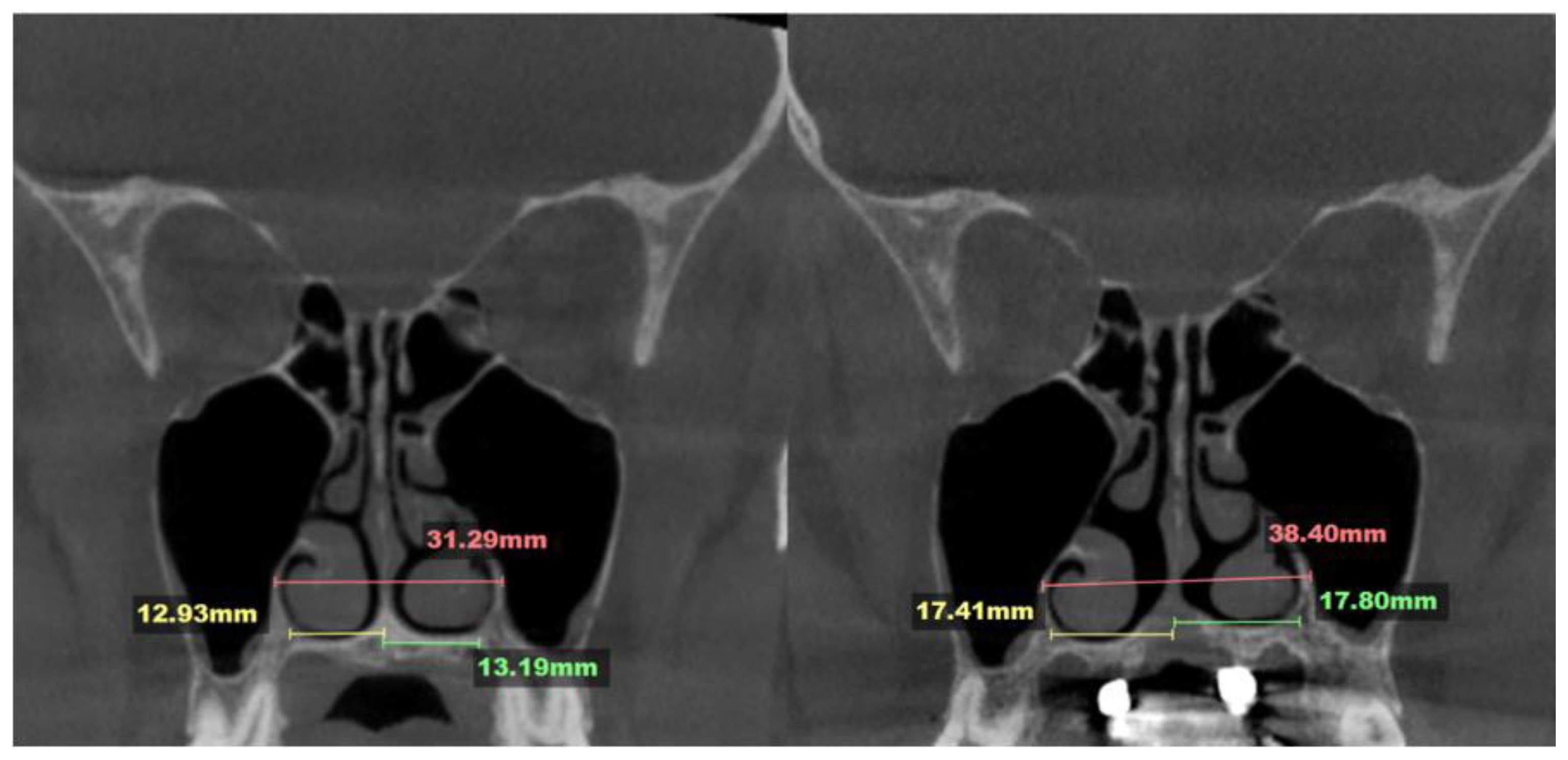 Preprints 163880 g010