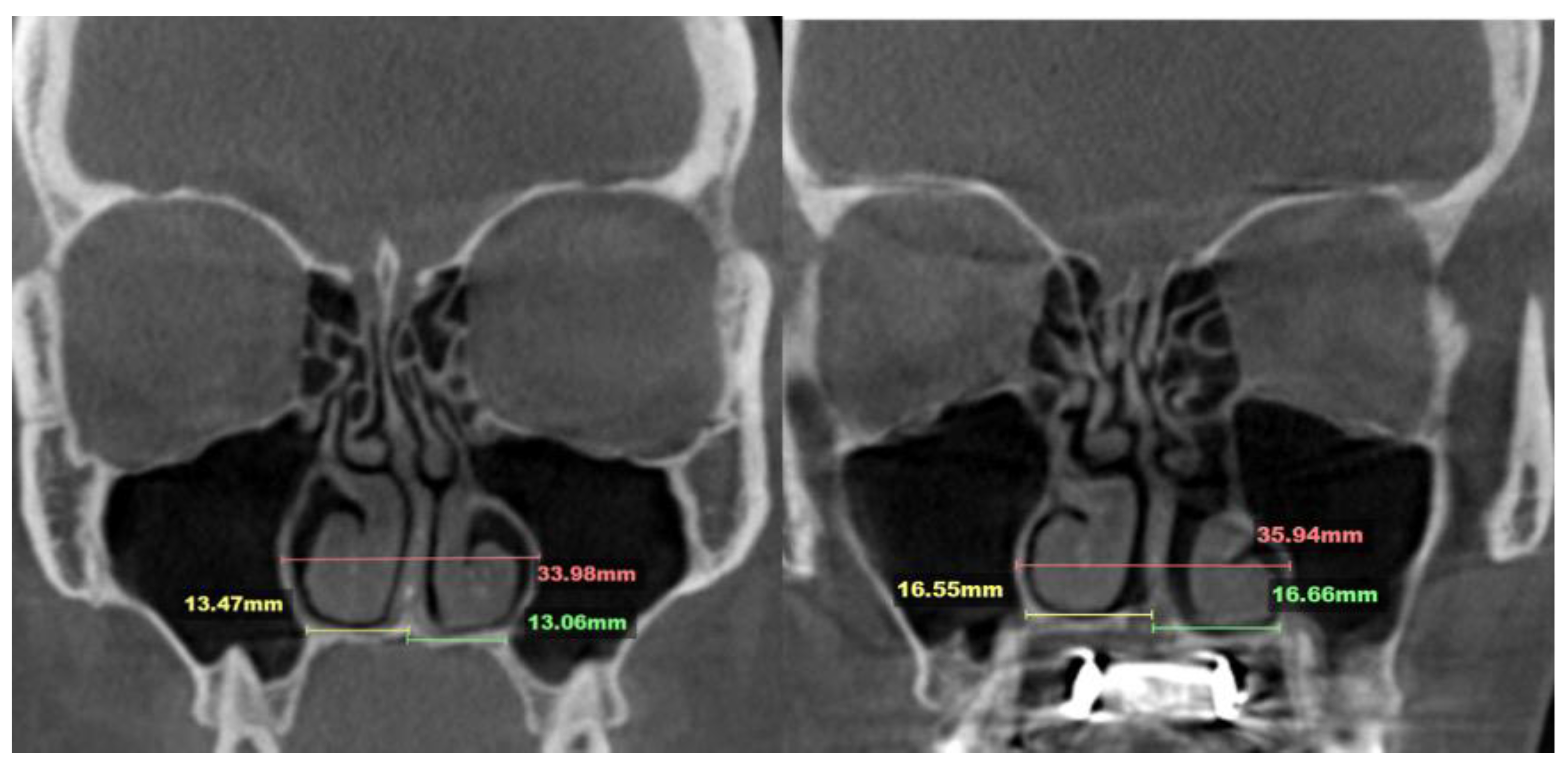 Preprints 163880 g012