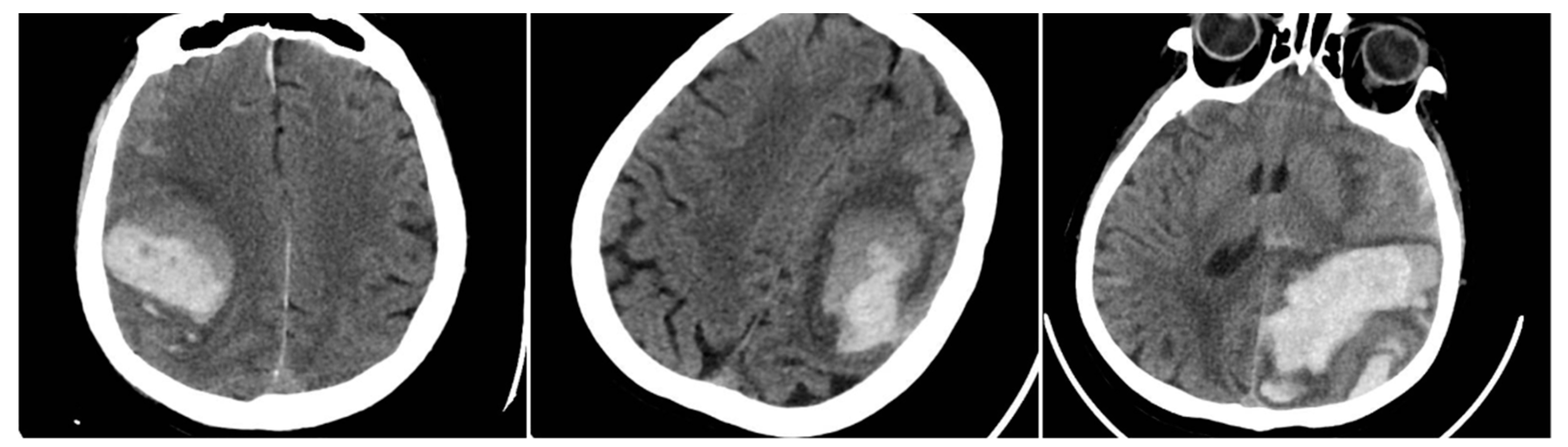 Preprints 159420 g001