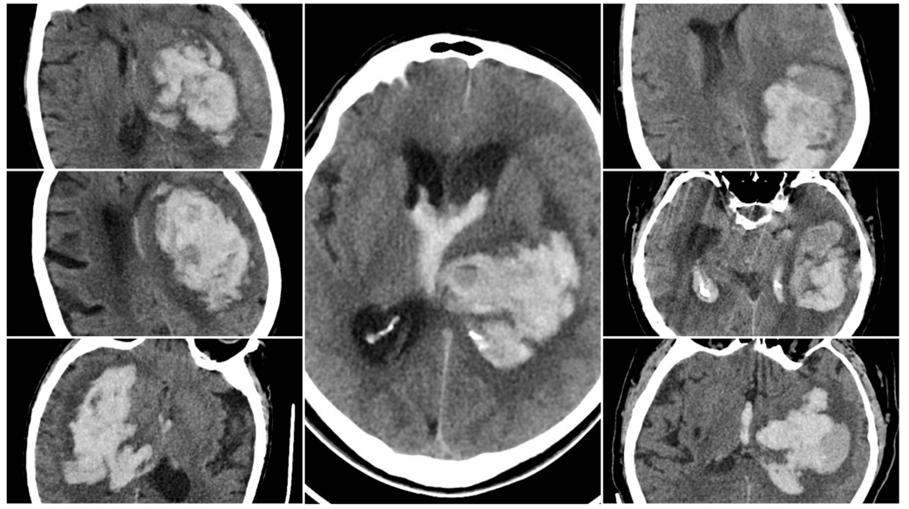 Preprints 159420 g006