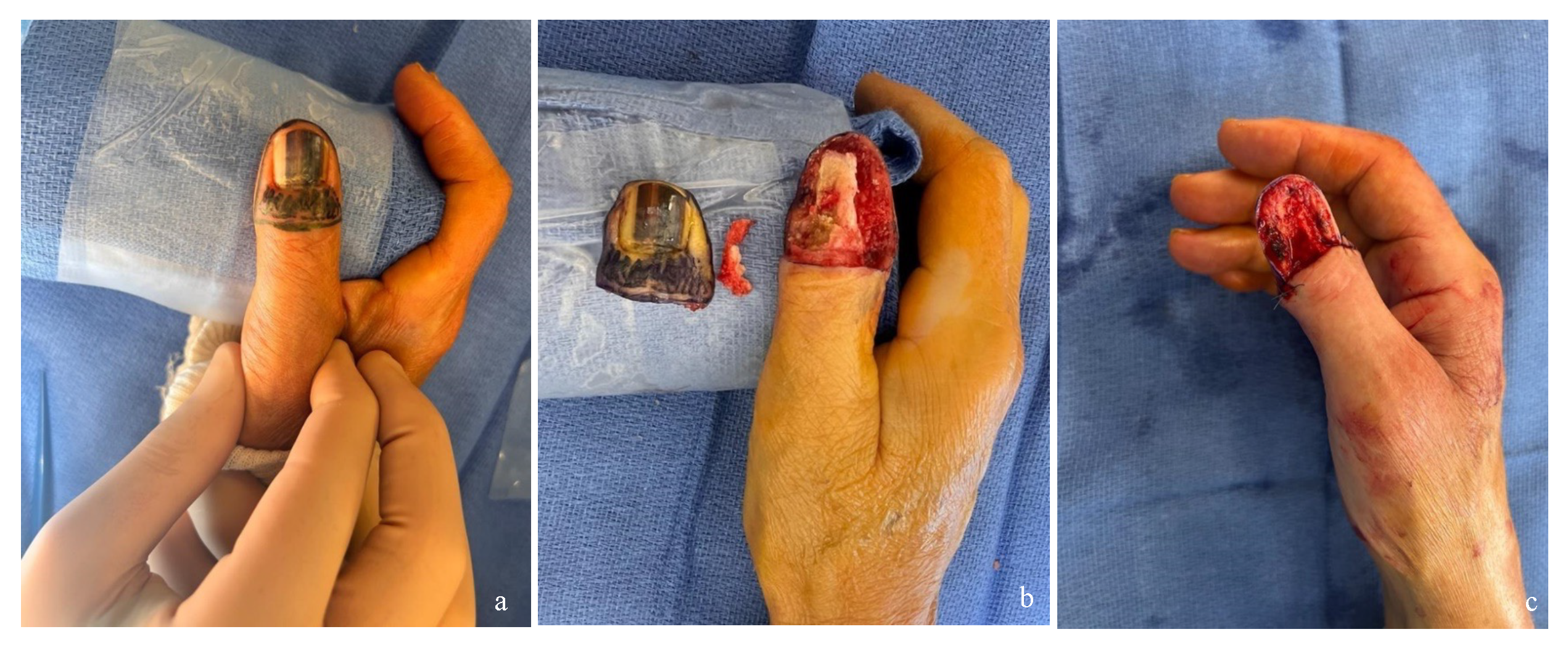 Preprints 162213 g002