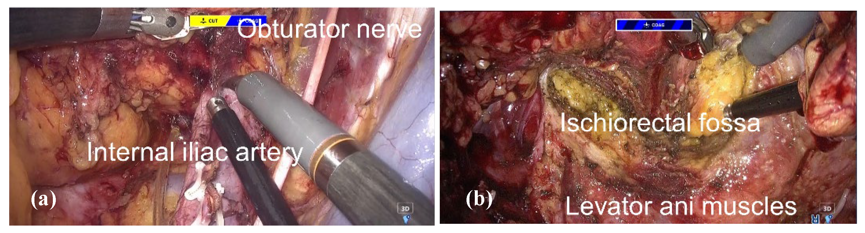Preprints 170632 g005