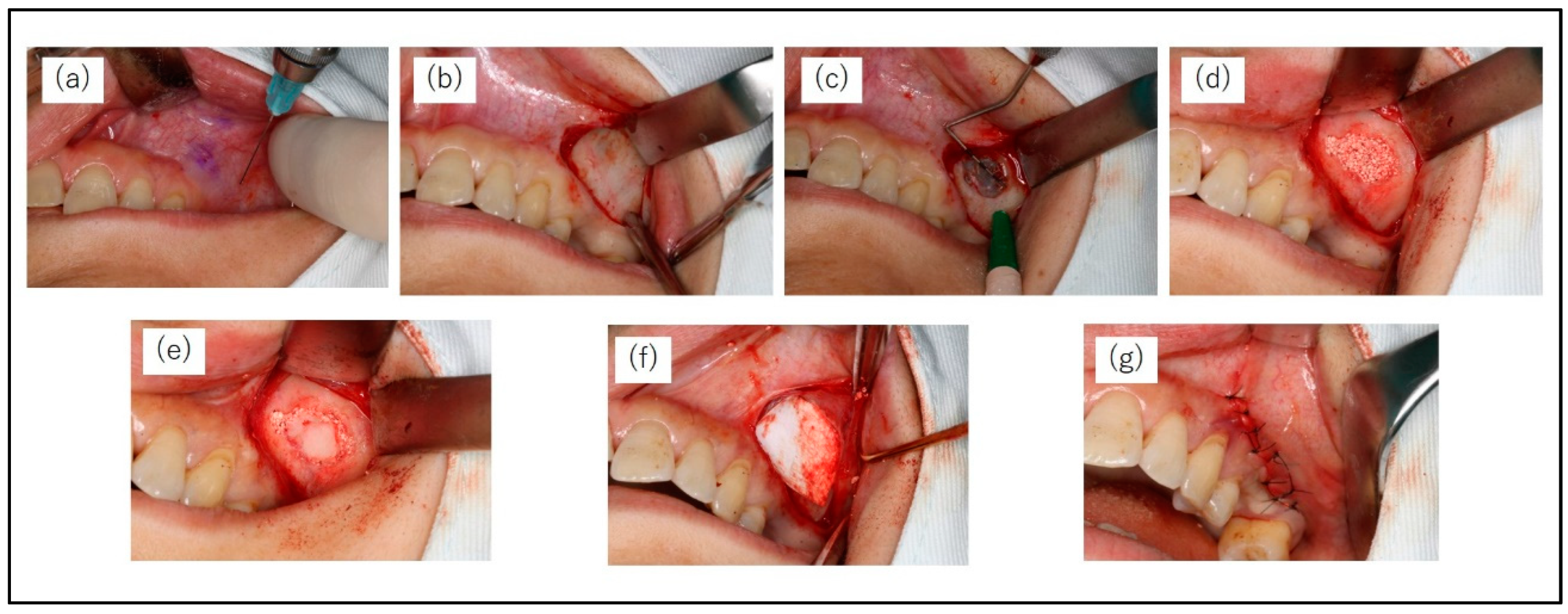 Preprints 83348 g003