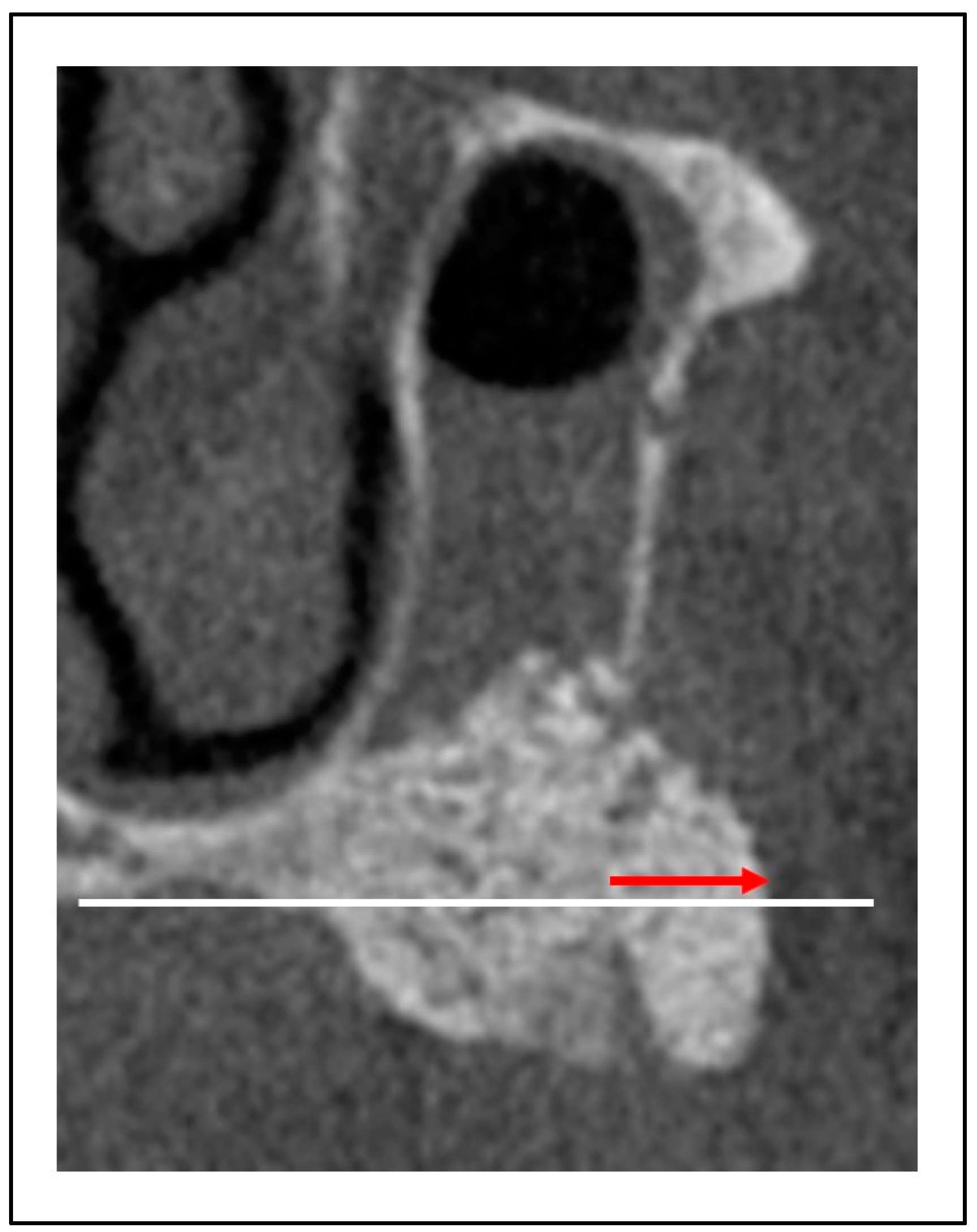 Preprints 83348 g004