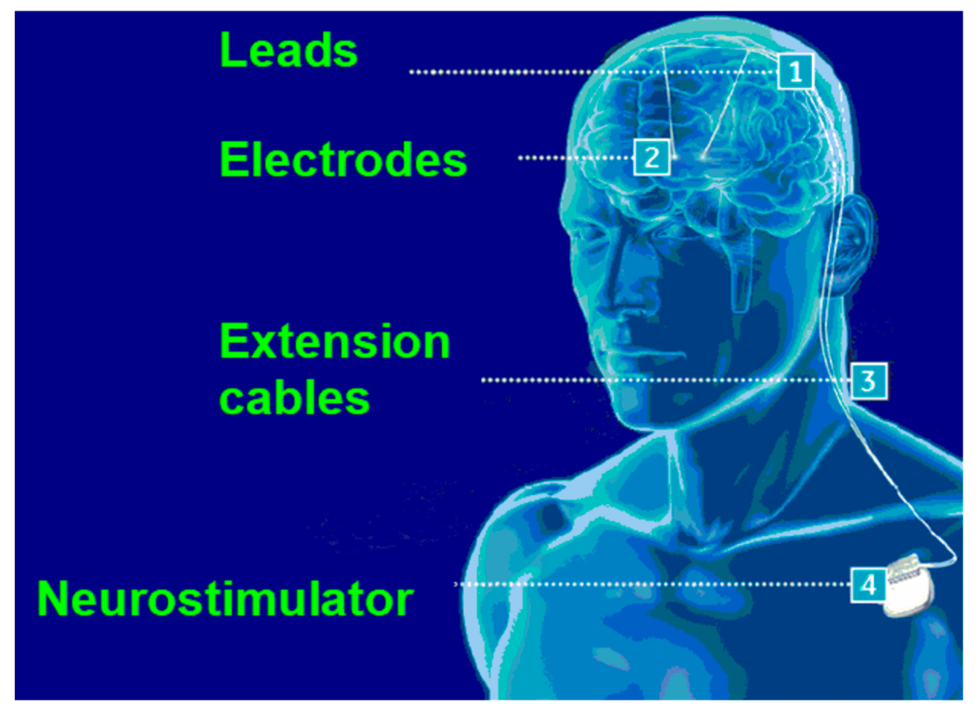 Preprints 76218 g001