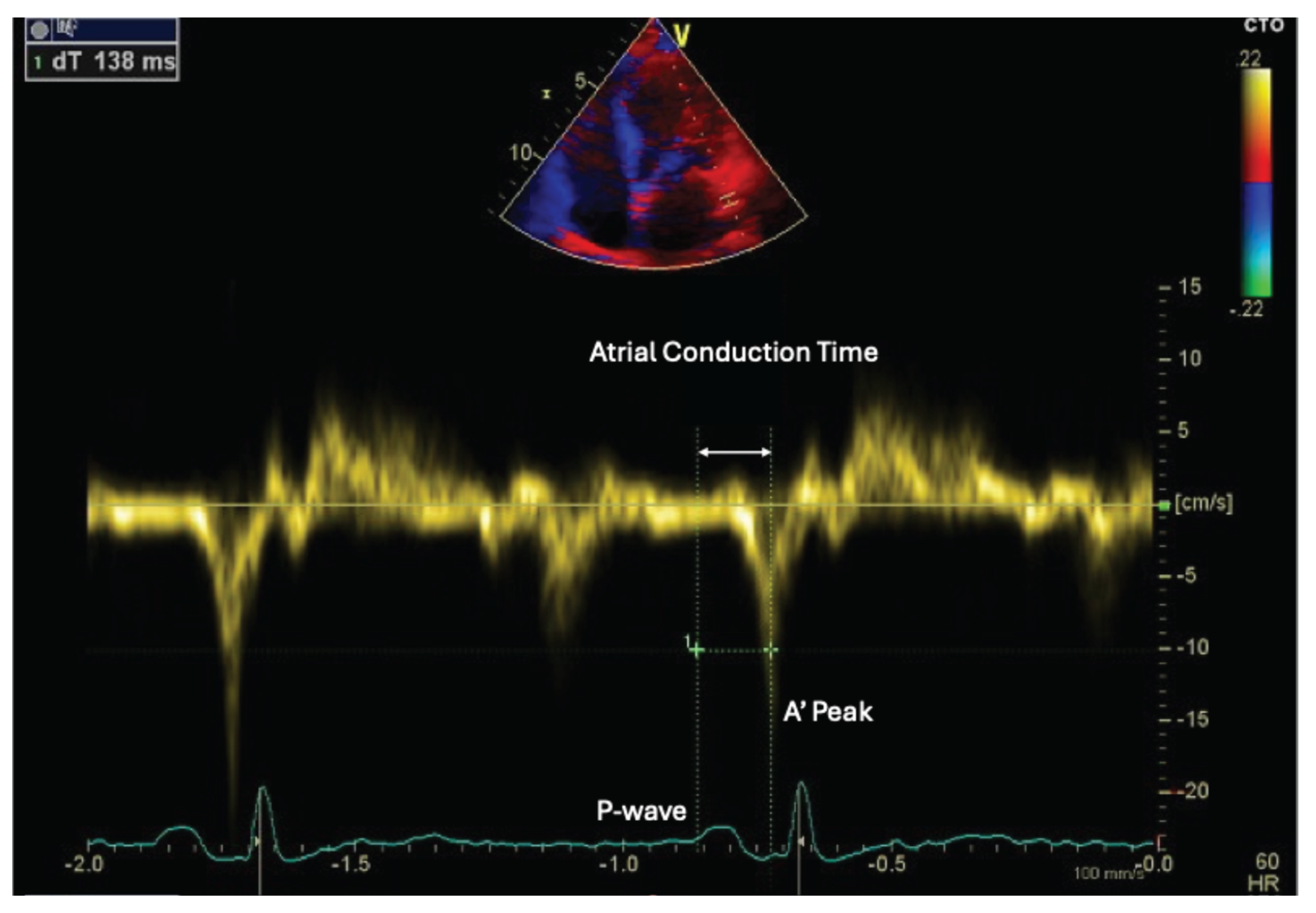 Preprints 195528 g004