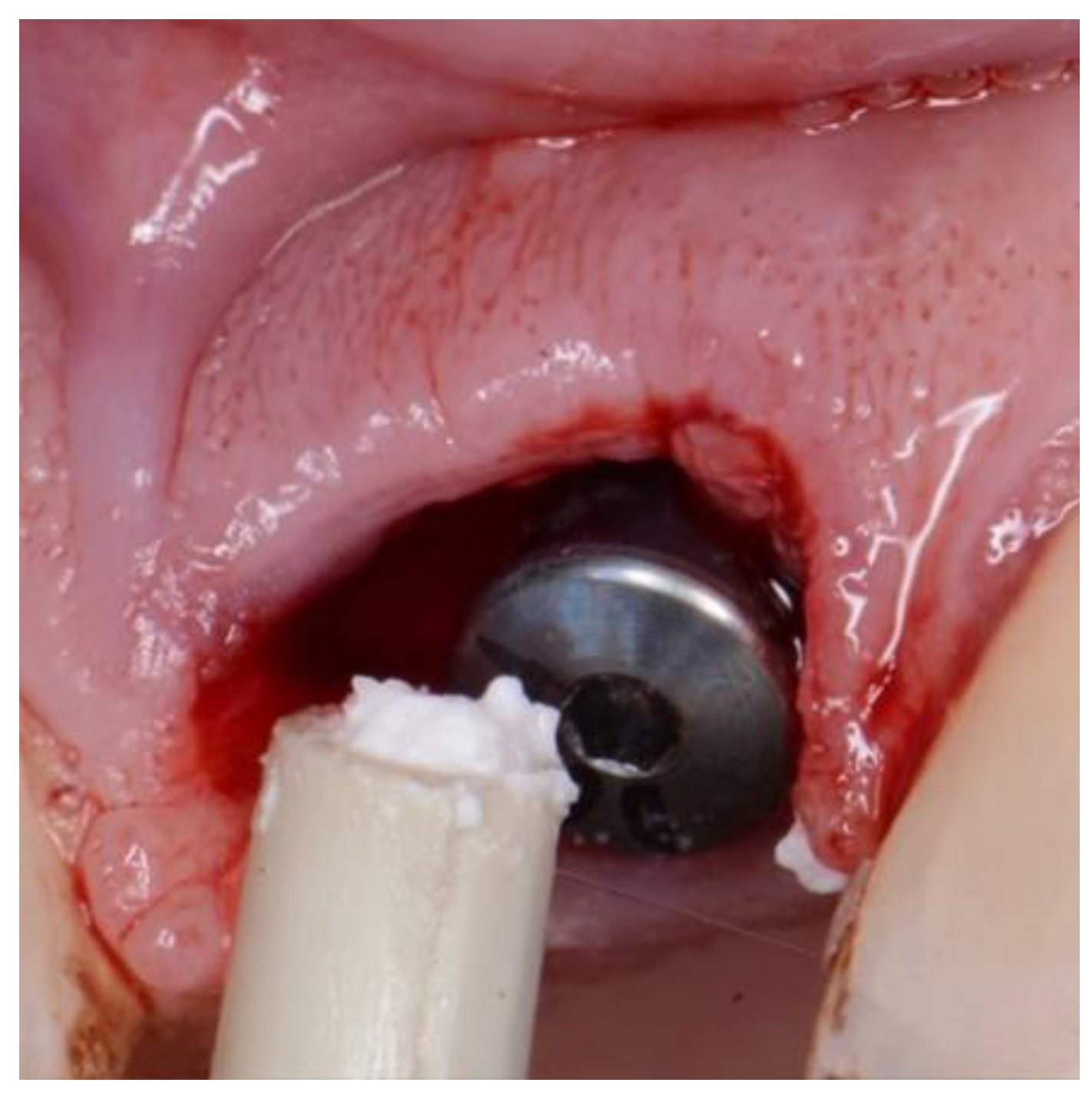 Preprints 86078 g004