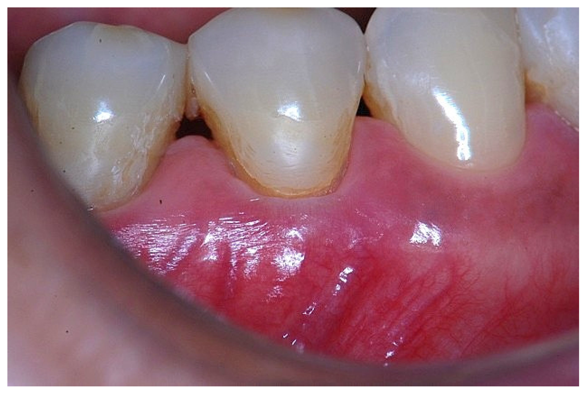 Preprints 186935 g004