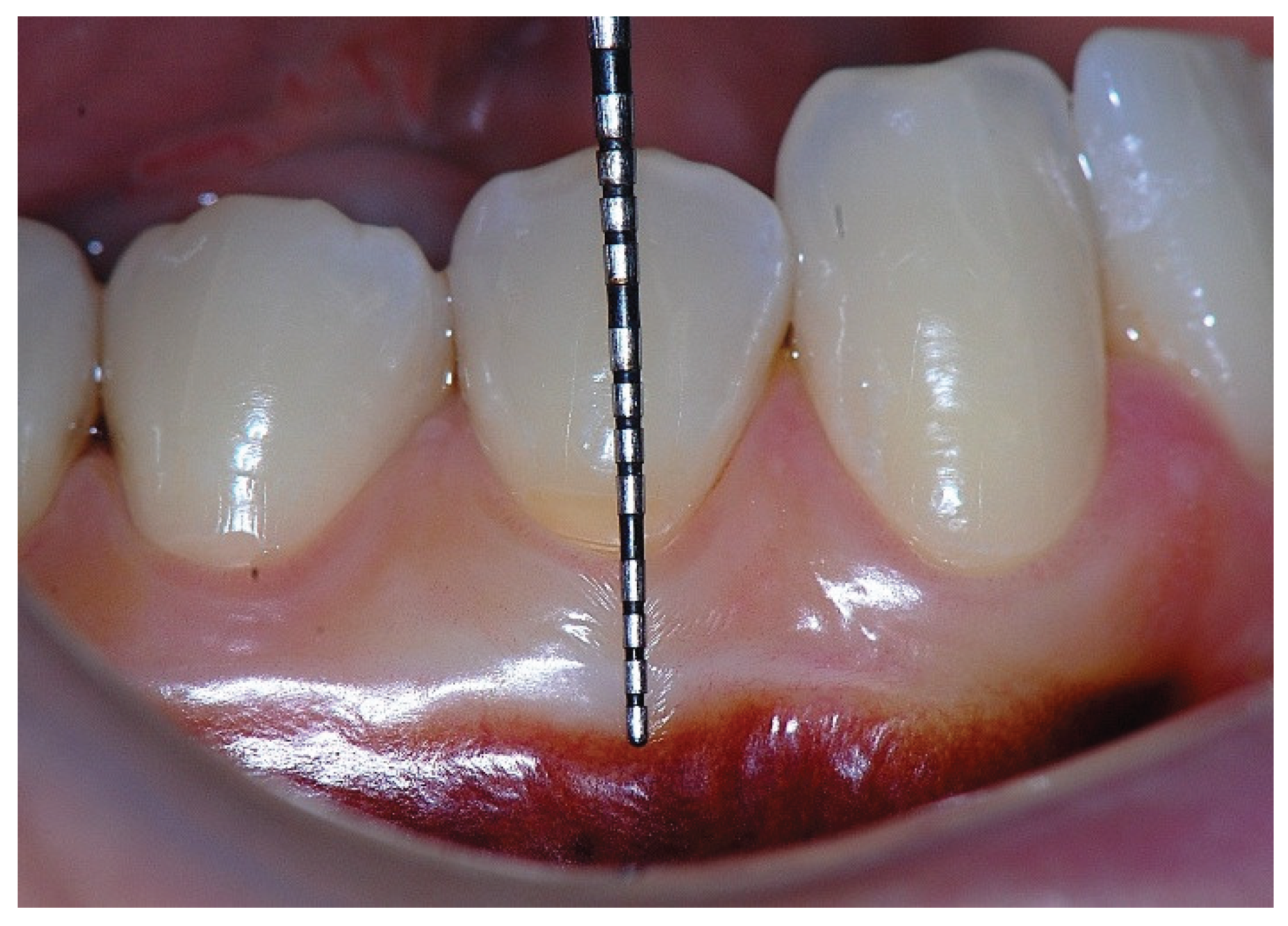 Preprints 186935 g011